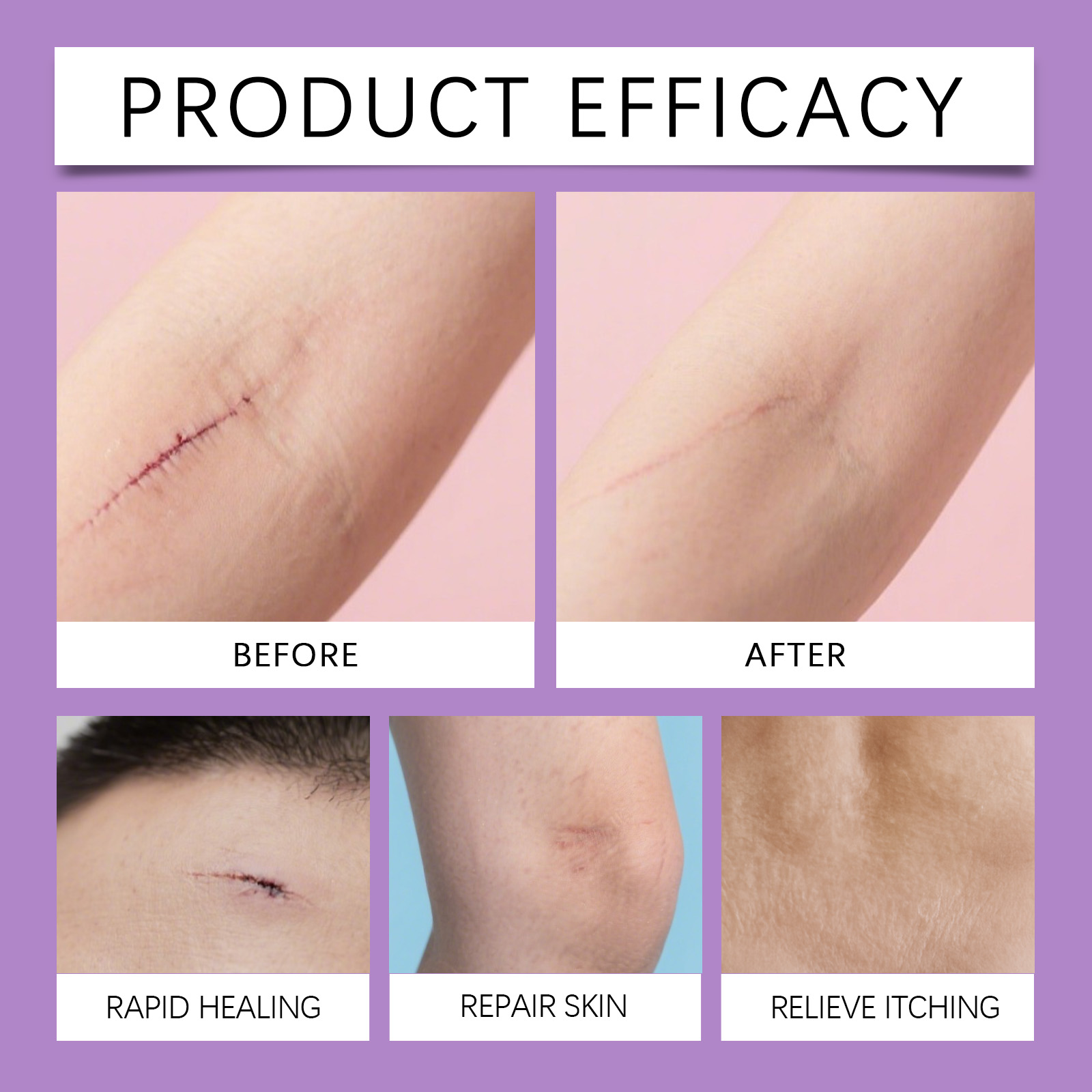 Skin Care Spray Mild Formula Nourish Smooth Delicate Soft External Apply Skin Treatment