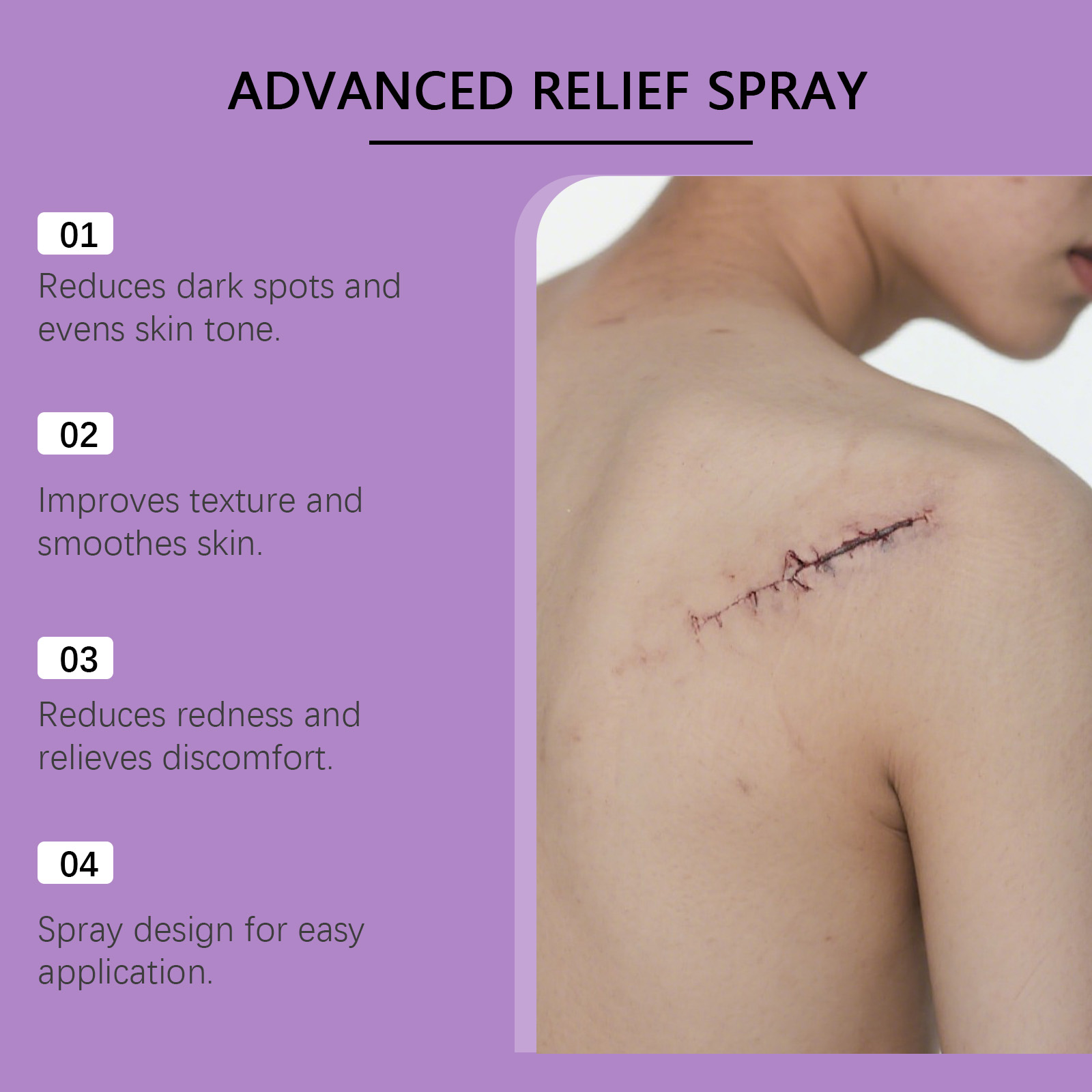 Skin Care Spray Mild Formula Nourish Smooth Delicate Soft External Apply Skin Treatment