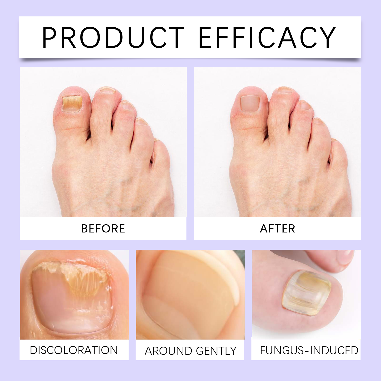 Toenail Care Essence Liquid Soft Bright Nail Surface Toe Mild Moist Daily Care Hand Foot Essence