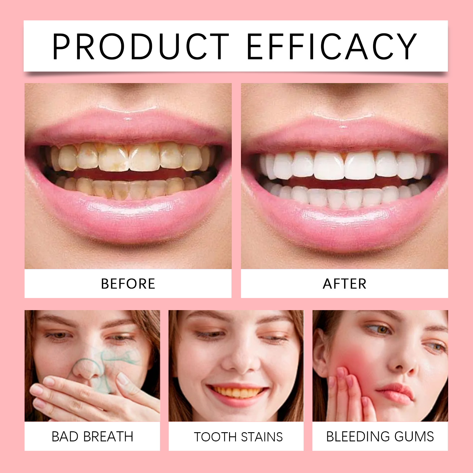 Probiotic Toothpaste Gentle Cleansing Protects Teeth Reduces Stains Long Lasting Oral Care