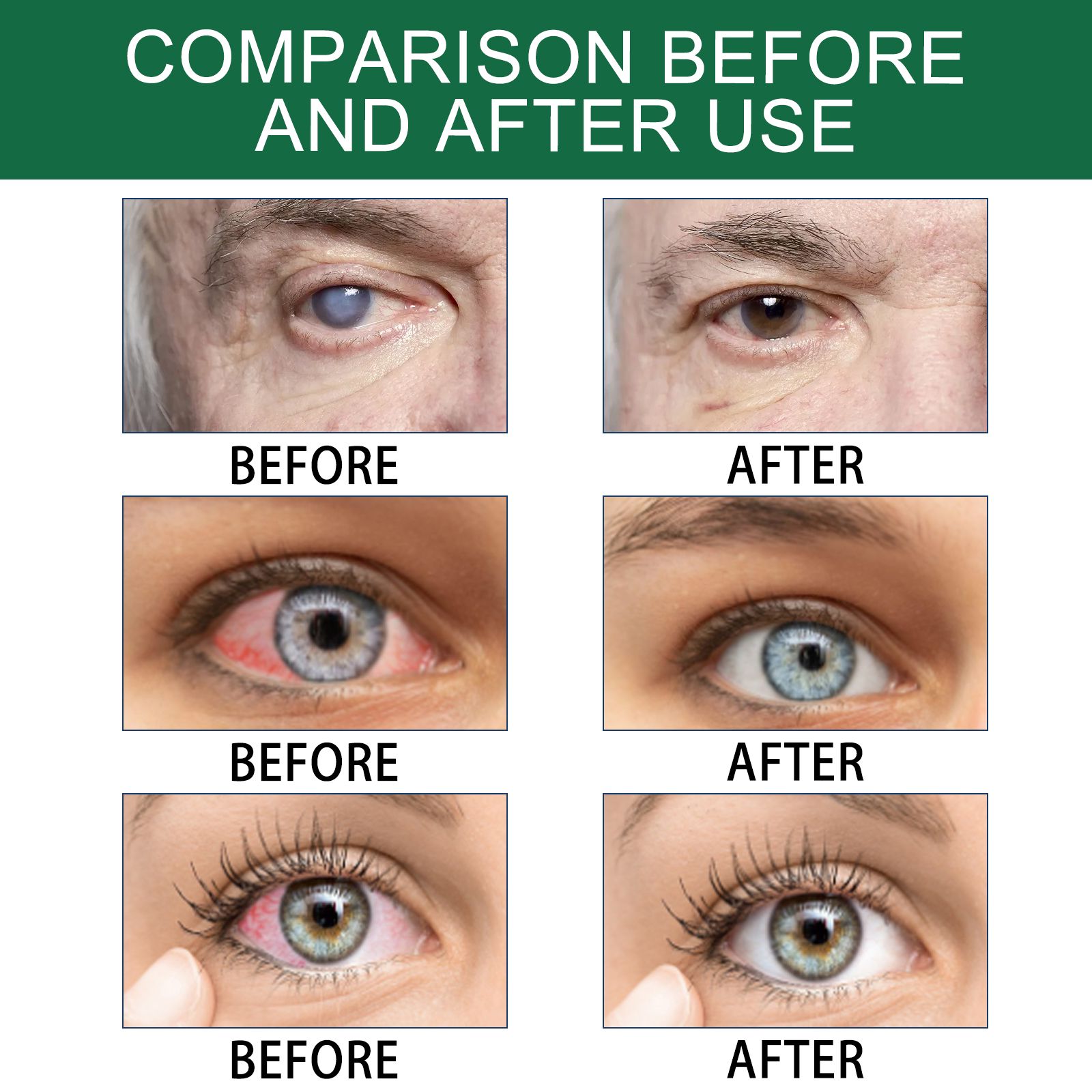 Eye Drops For Dry Tired Eyes Moisturizing Soothing Relief And Daily Eye Care