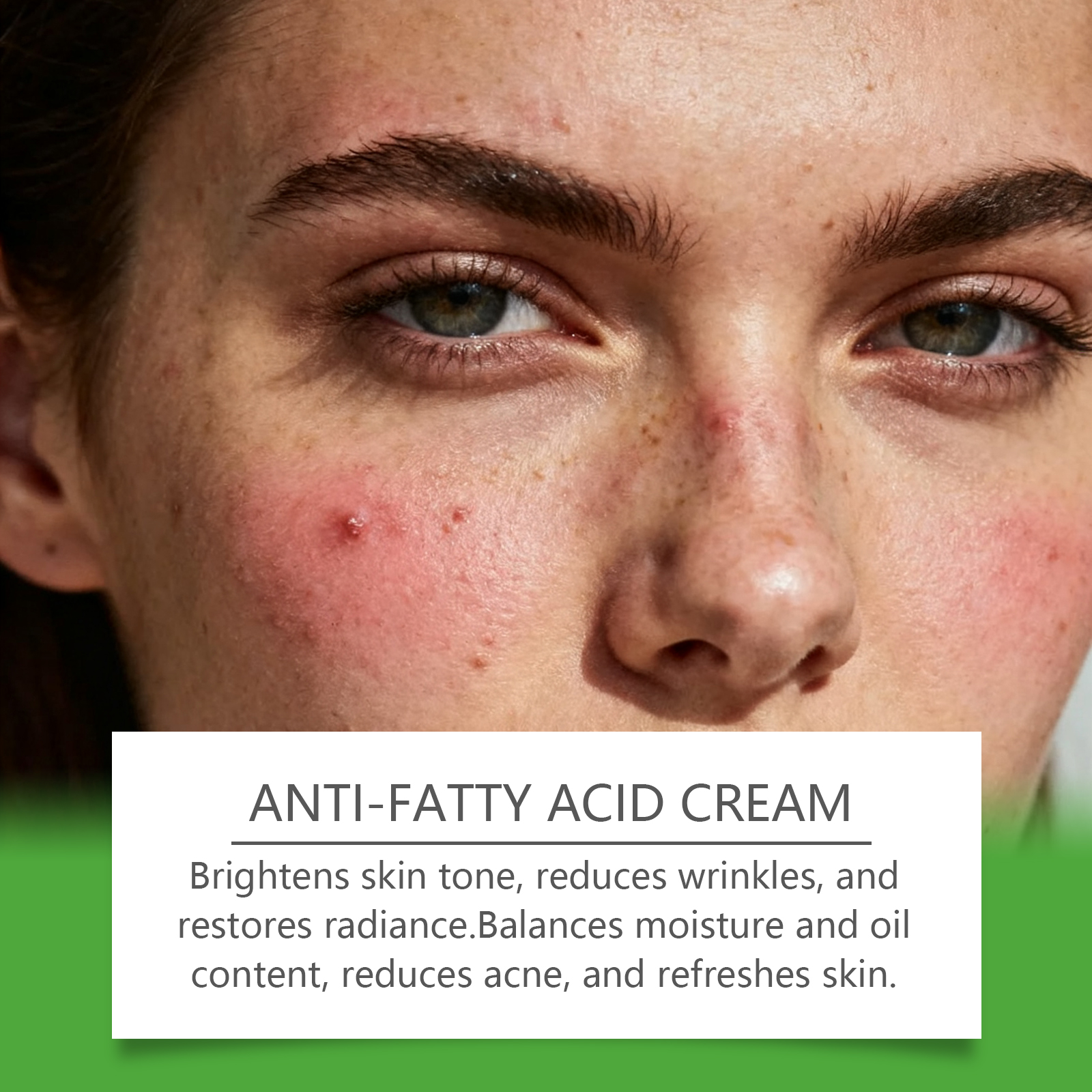 Skin Care Cream Mild Body Clean Remove Acne Pimple Moist Soft Daily External