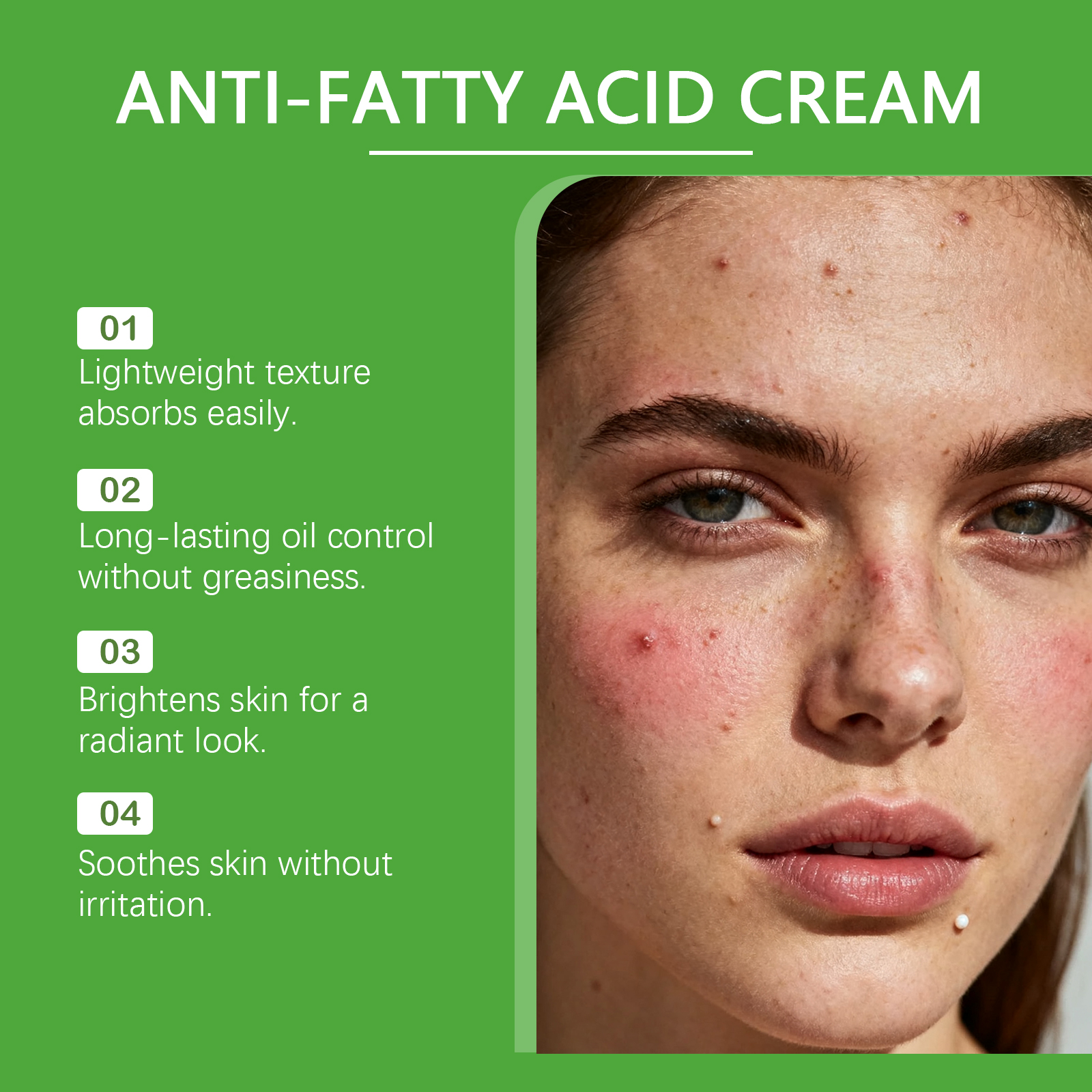 Skin Care Cream Mild Body Clean Remove Acne Pimple Moist Soft Daily External