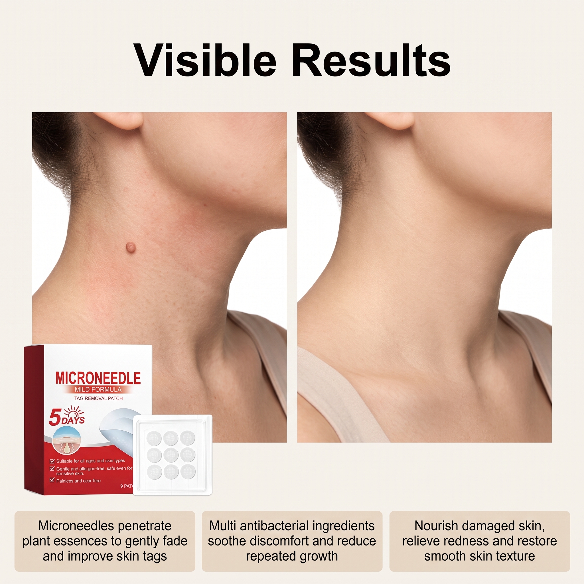 Skin Care Patch Gentle Clean Body Local Flaw Smooth Tender Skin Moisturizing Skin Friendly Patch