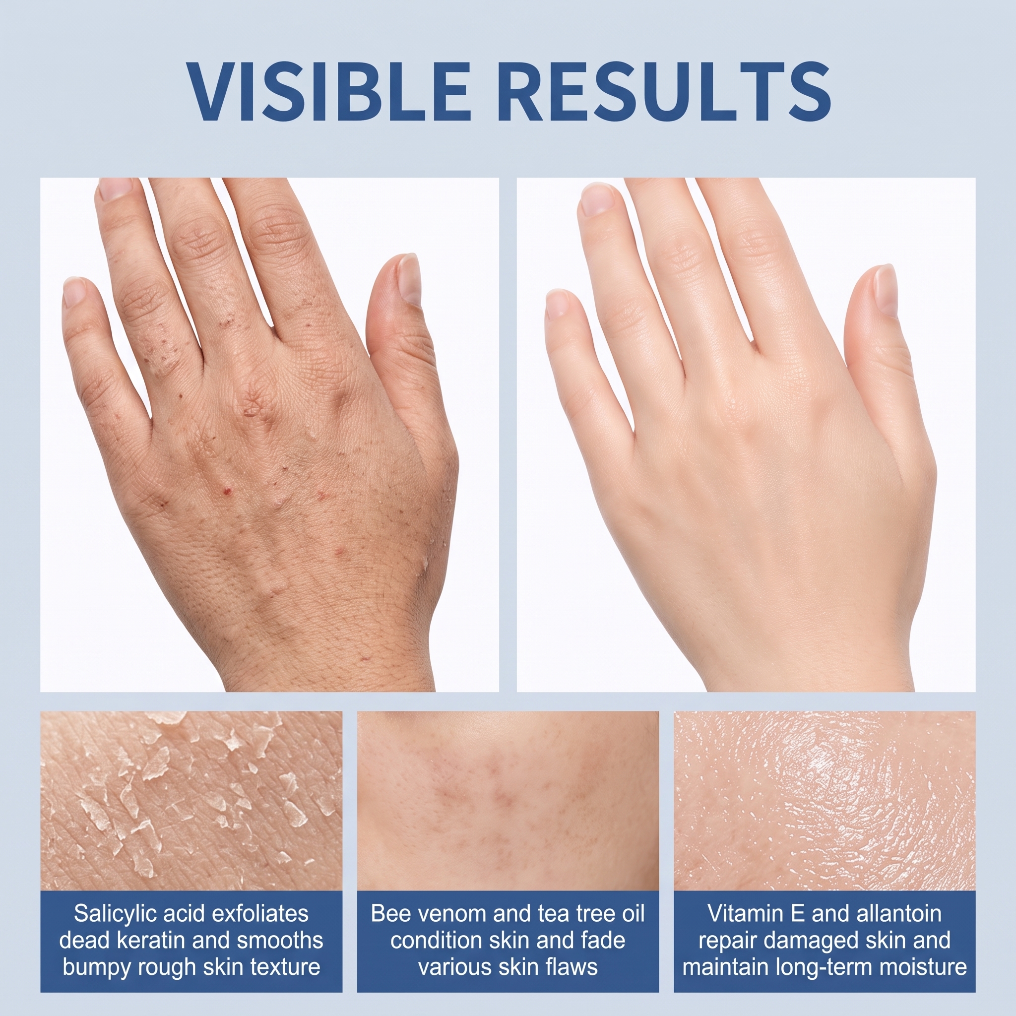 Skin Care Spray Cream Soften Surface Cutin Improve Skin Bumps Fade Defect Marks Daily Moisturizing Maintenance