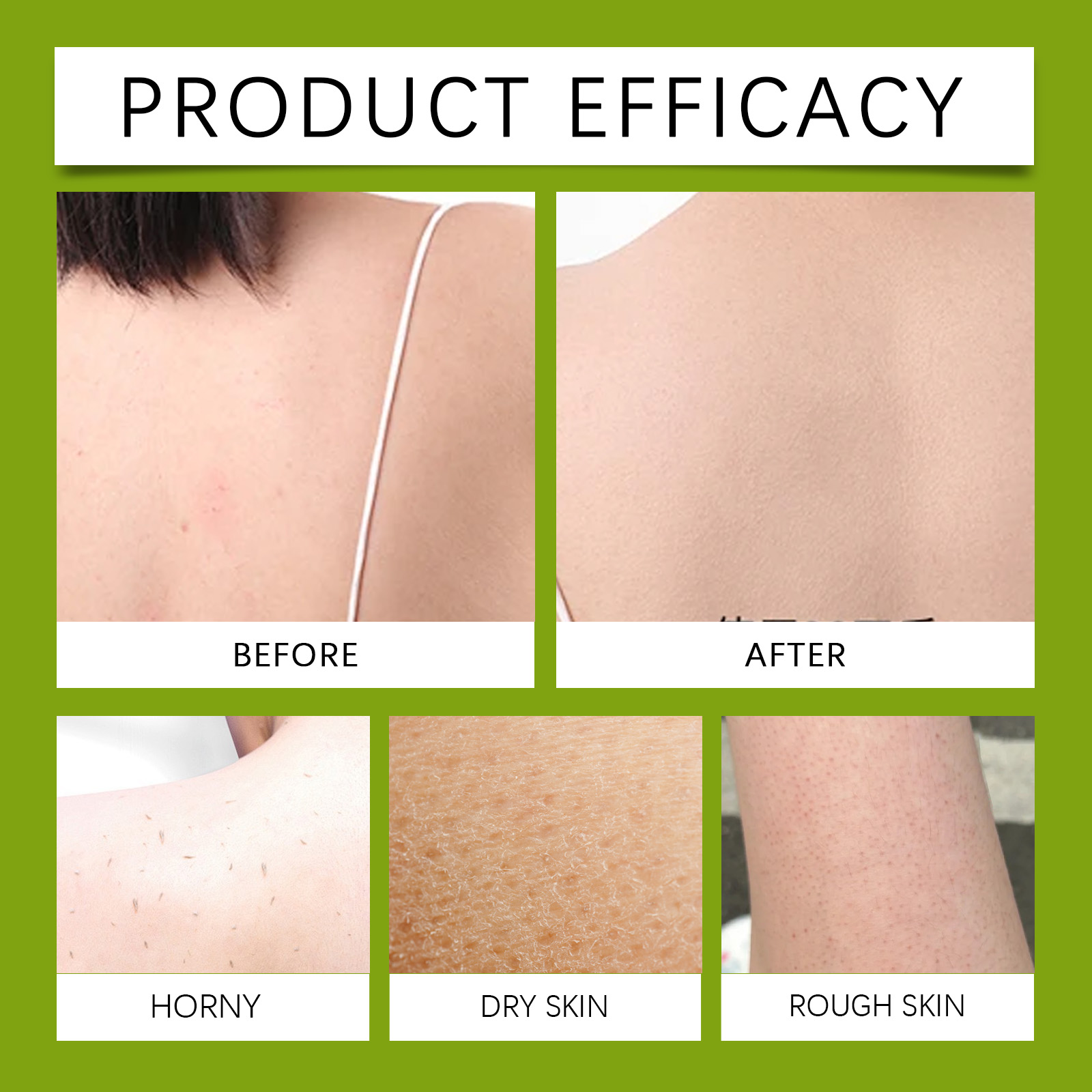 Tea Tree Oil Skin Soap Gentle Cleansing Refreshing Bath Comfort Moisturizing Nourishing Skin Care