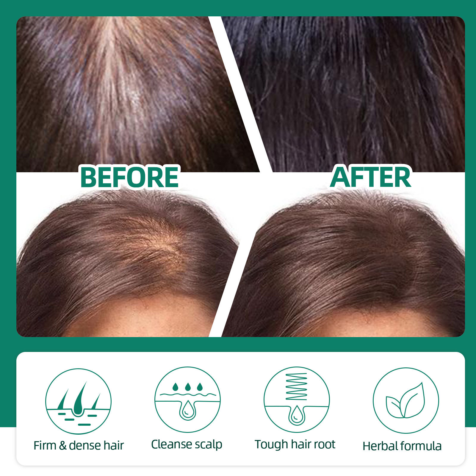 Hair Growth Spray Natural Intensive Essence Moisturizing Hair Essence Hair Care Products for hicker Longer Hair Anti Hair Loss for Men Women 60ml