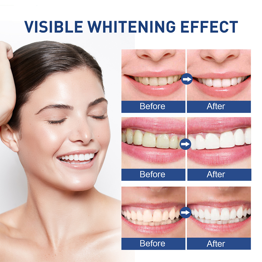 (1pcs) Teeth Whitening Paint Tooth Gel Teeth Whitener Bleach Remove Stains Oral Hygiene Instant Smile Teeth Whitening Kit Cleaning Serum 5ml