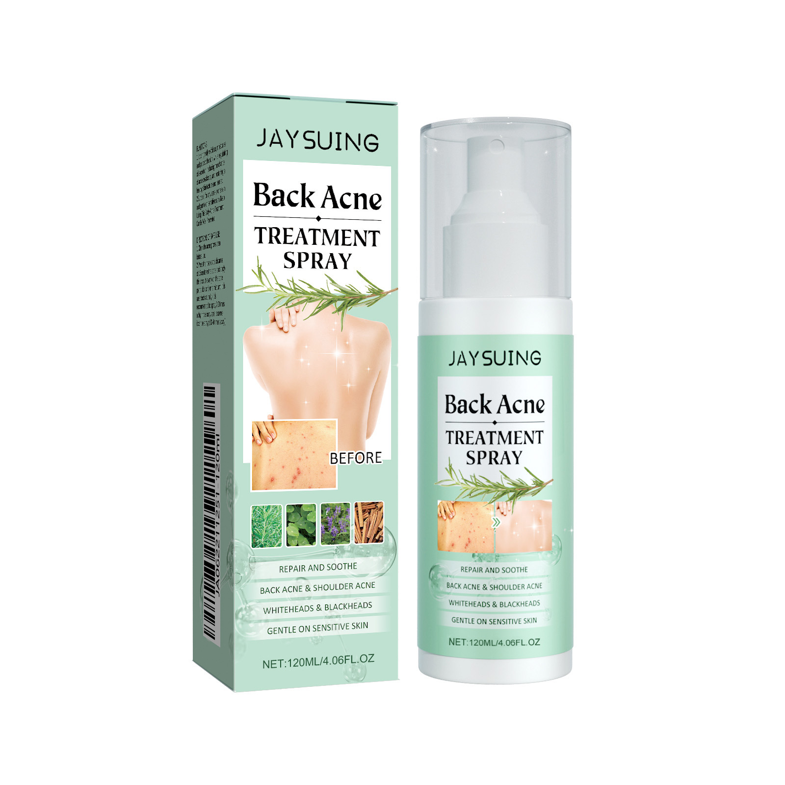 (1 PC) Back Care Spray Back Acne Remover Spray Shoulder Pimple Repair Whiteheads Treatment Blackhead Anti Mites Oil Control Hydrate Body Soothing Serum