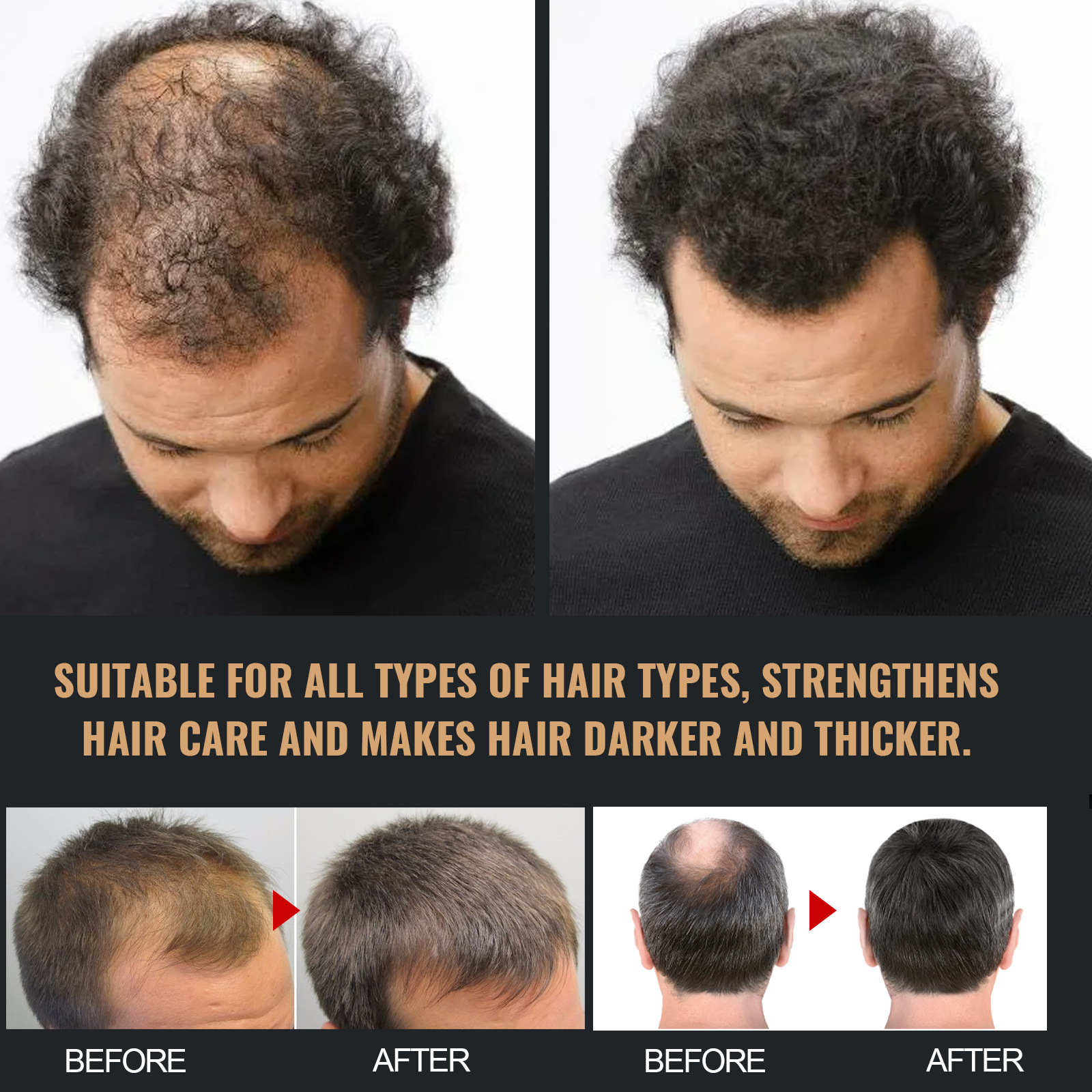 Root Activating Shampoo Control Volume Essence Oil Anti Baldness Colorng Cream Cover Dye Shampoo Fast Thicker Dense Deep Cleansing Follicles 100ml