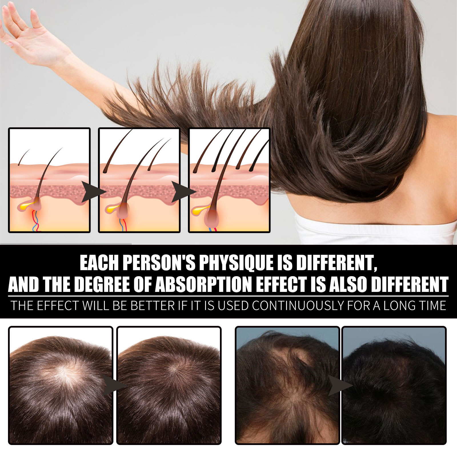 Biotin Oil Fast Hair Regrowth Serum Hair Essential Oil Hair Thinning Treatment Liquid Anti-hair Loss For Women Men 30ml