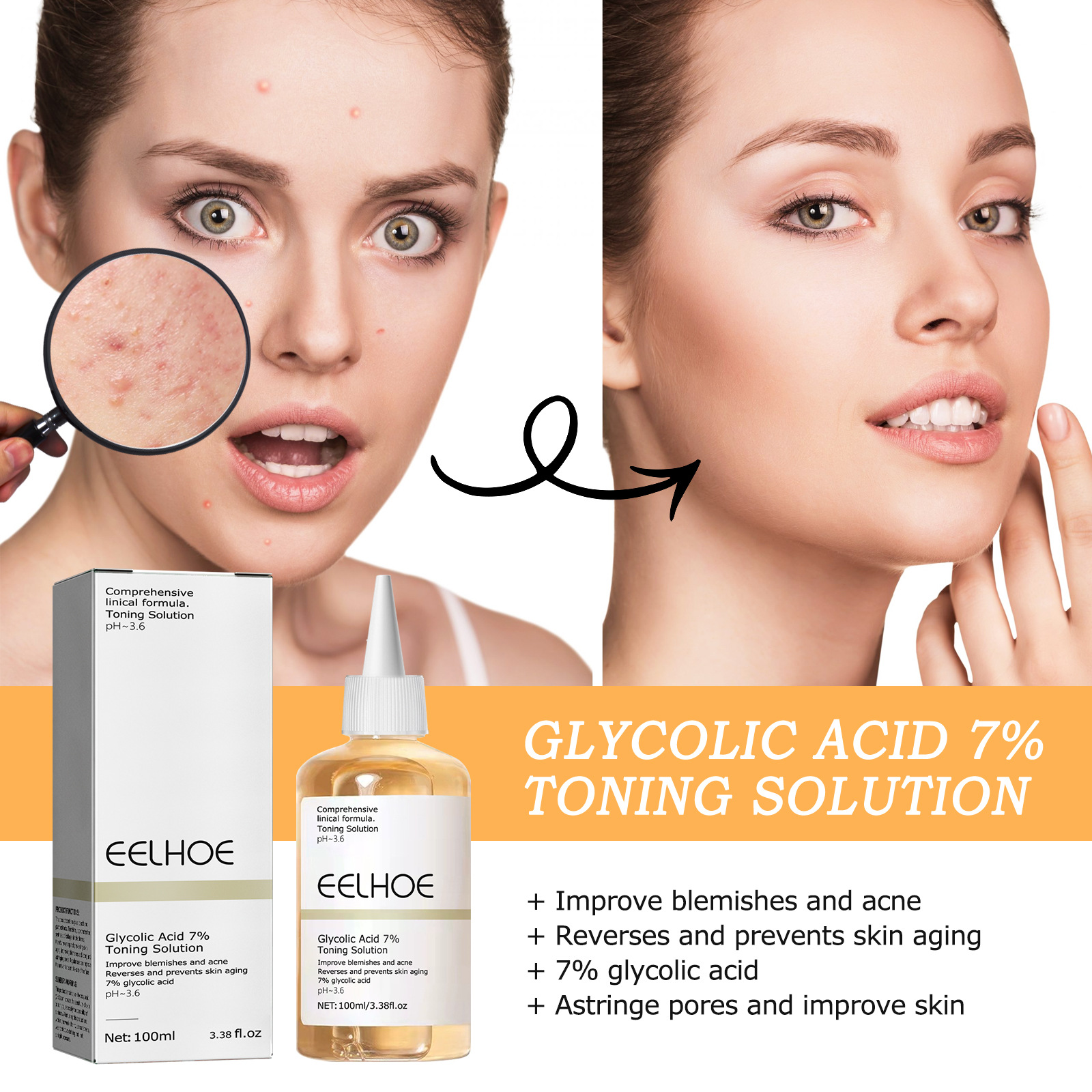 Face Toner for Women Glycolic Acid 7 Percent Toning Resurfacing Solution Improve Blemishes Remove Acne Marks Skin Care