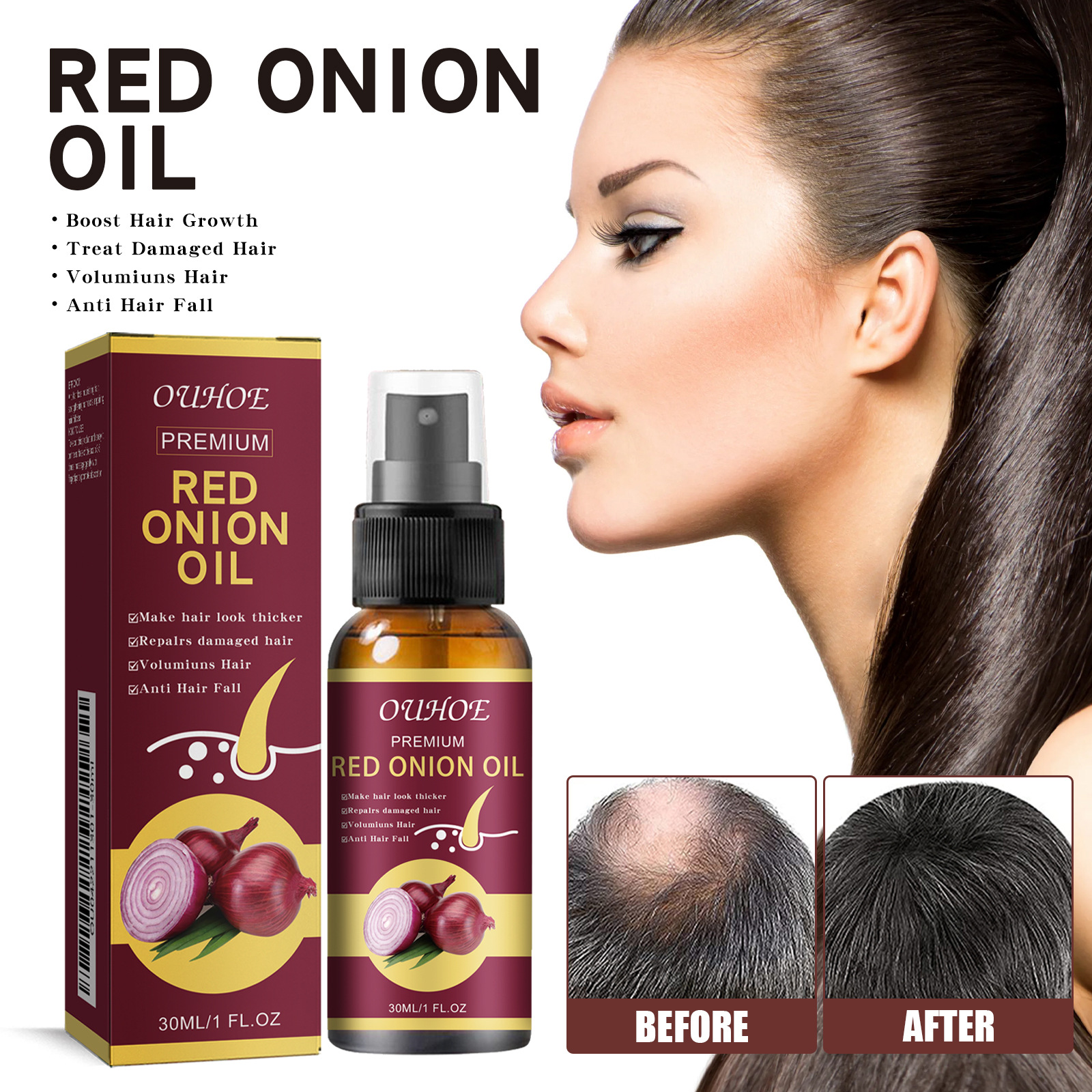 Hair Growth Serum Spray Prevent Hair Loss Scalp Treatment Improve Alopecia Strengthening Anti Dry Frizz Red Onion Essential Oil Hair Care Oil