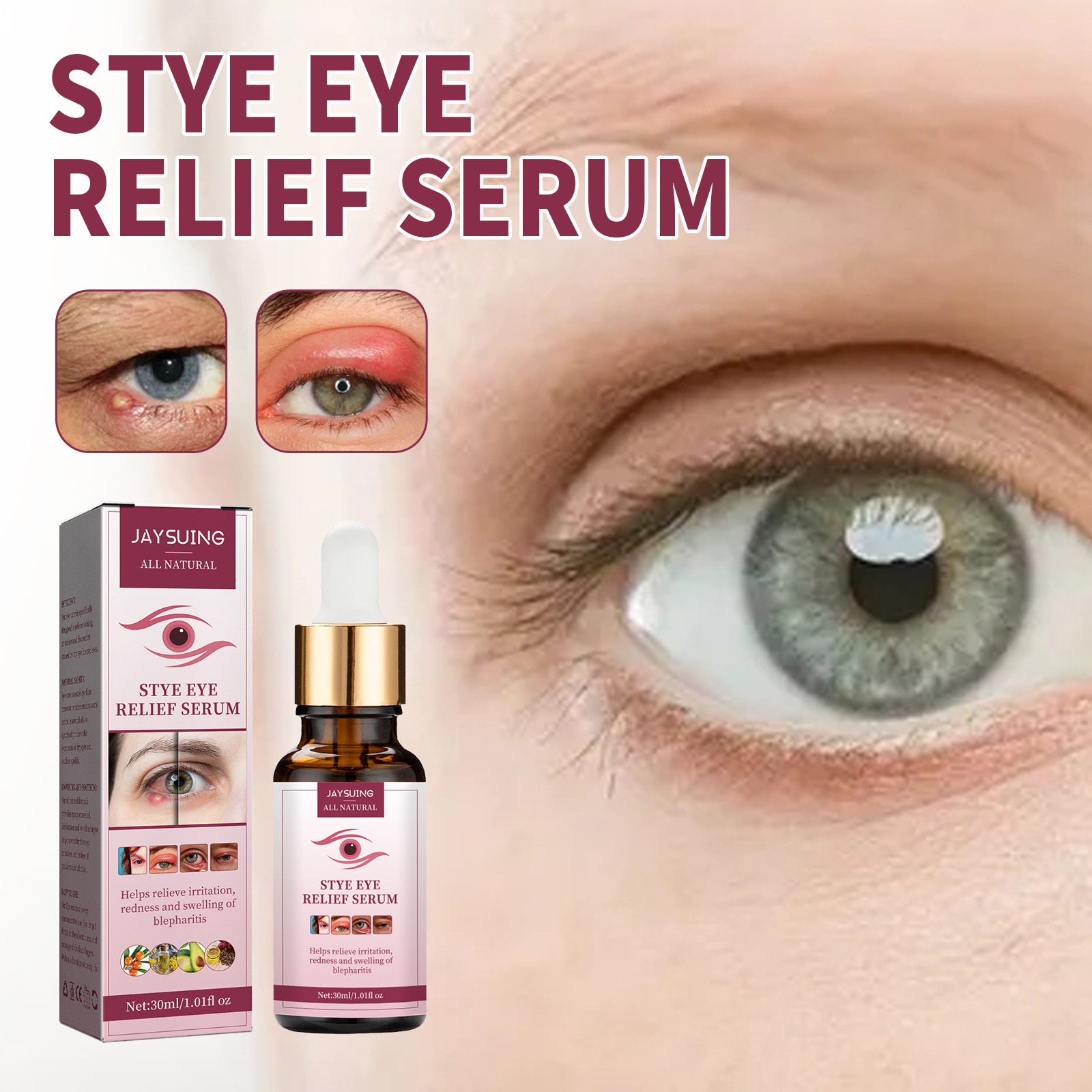 (1pc) Jaysuing Eye Swelling Relief Essence Relieve Fatigue Eyesight Remove Fat Granule Improve Redness Stye Eye Treatment Moisturizes Eye Serum 30ml