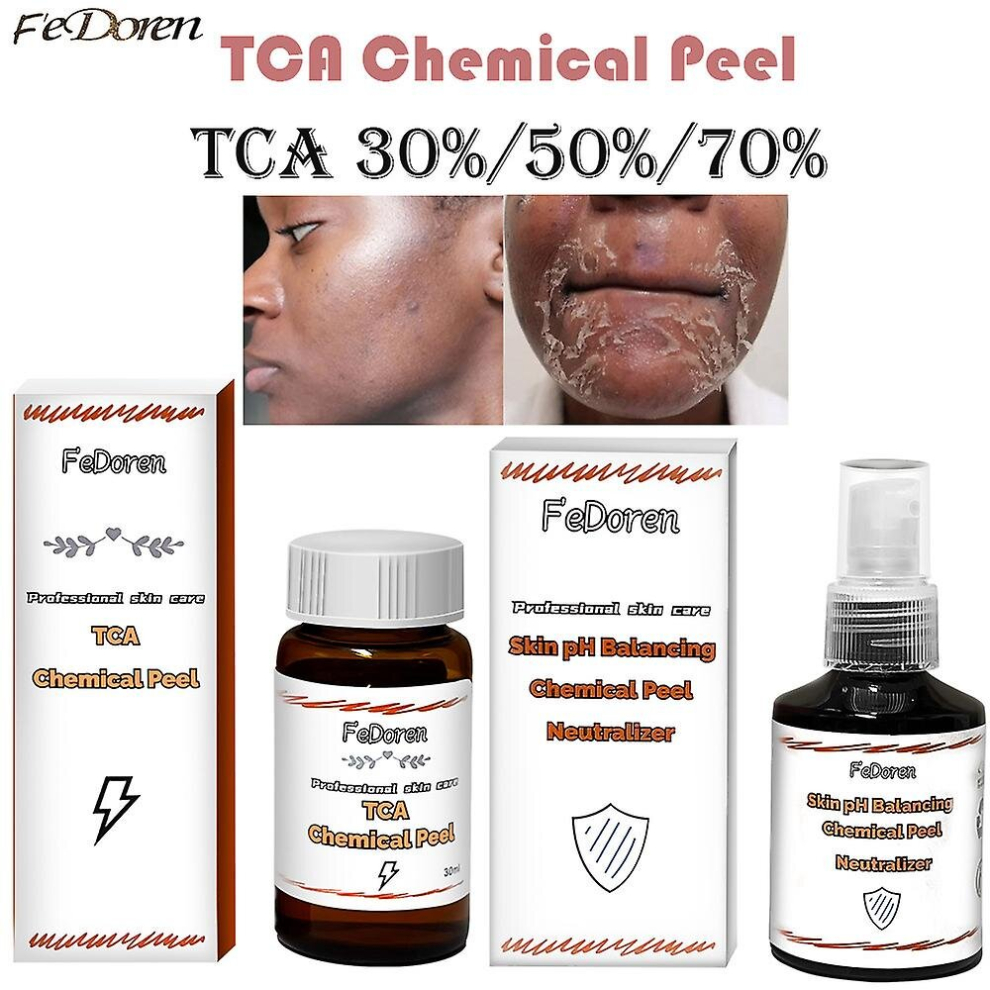 Tca 30 Percents  Tca Peel Acid Peeling Acid Skin Superforce Peeling Pigmentation Acne Scar