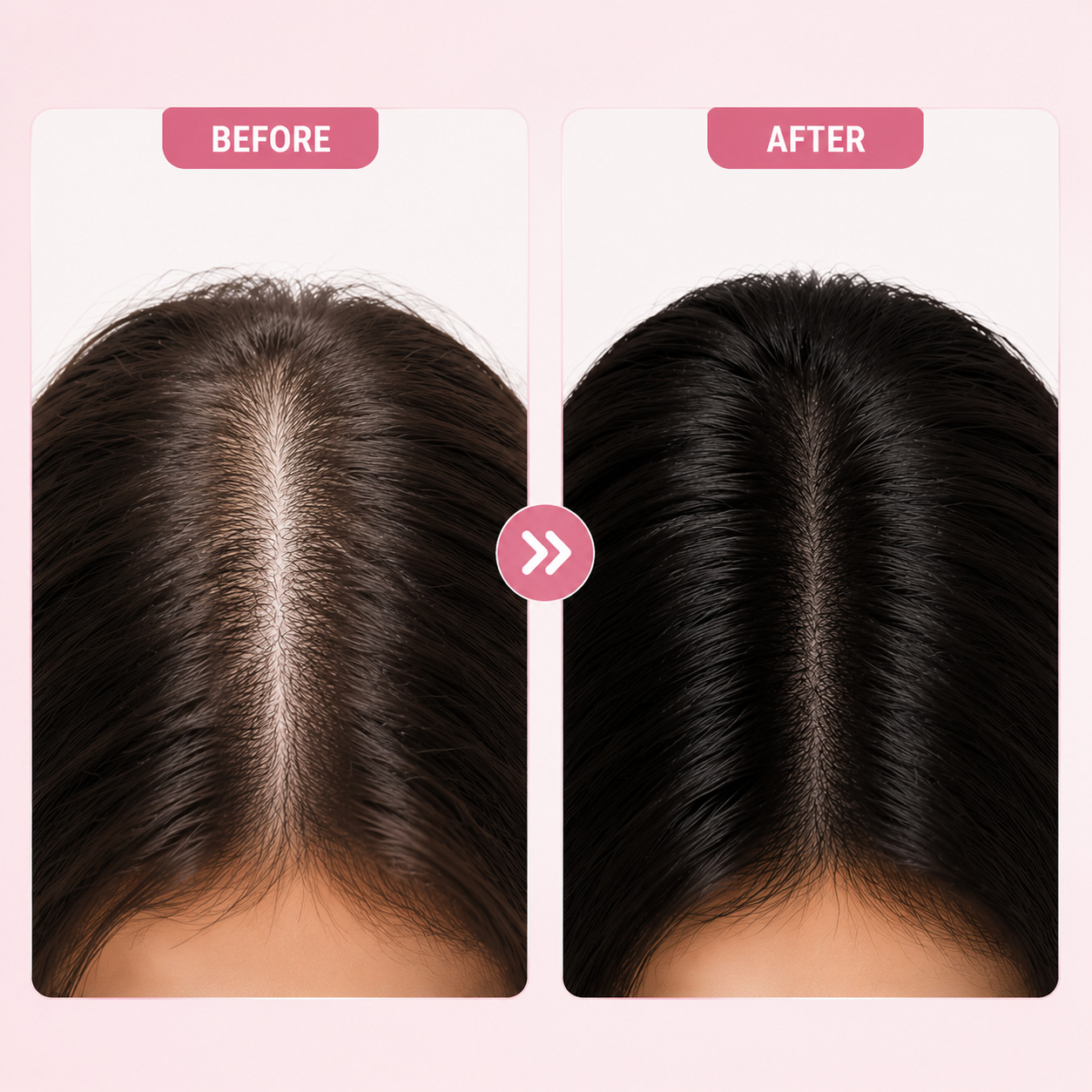 Rosemary PDRN Scalp Serum Nourishing Hair Root Strengthening Treatment for Daily Hair Care Natural 20ml
