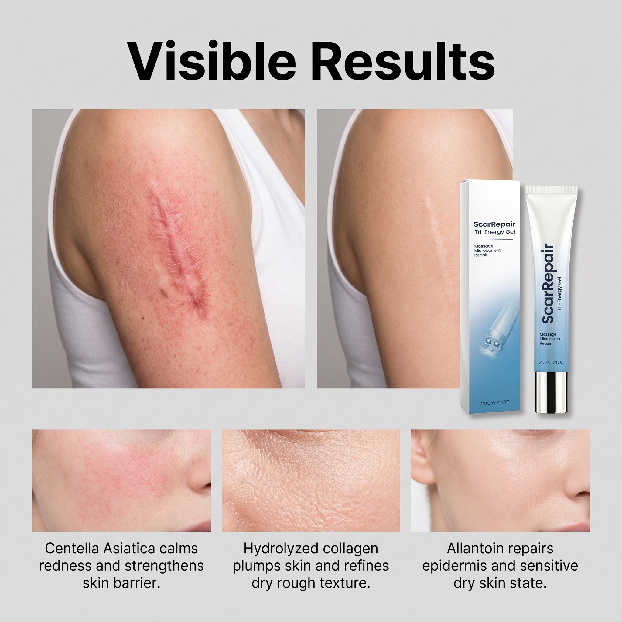 Skin Care Gel Centella Asiatica Nourish Body Local Skin Smooth Care Daily Moisturizing