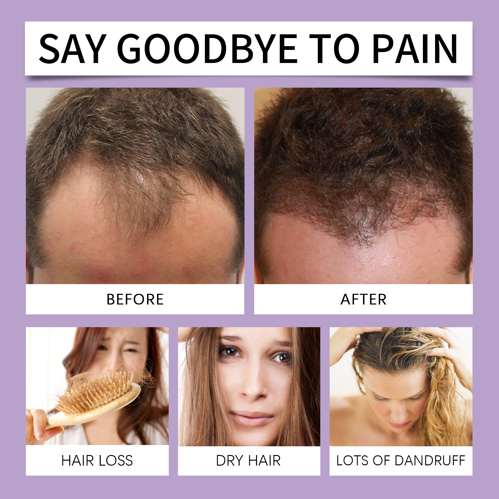 Hair Strengthening Serum Nourishing Scalp Root Care For Thinning Hair Volumizing Daily Hair Care Treatment