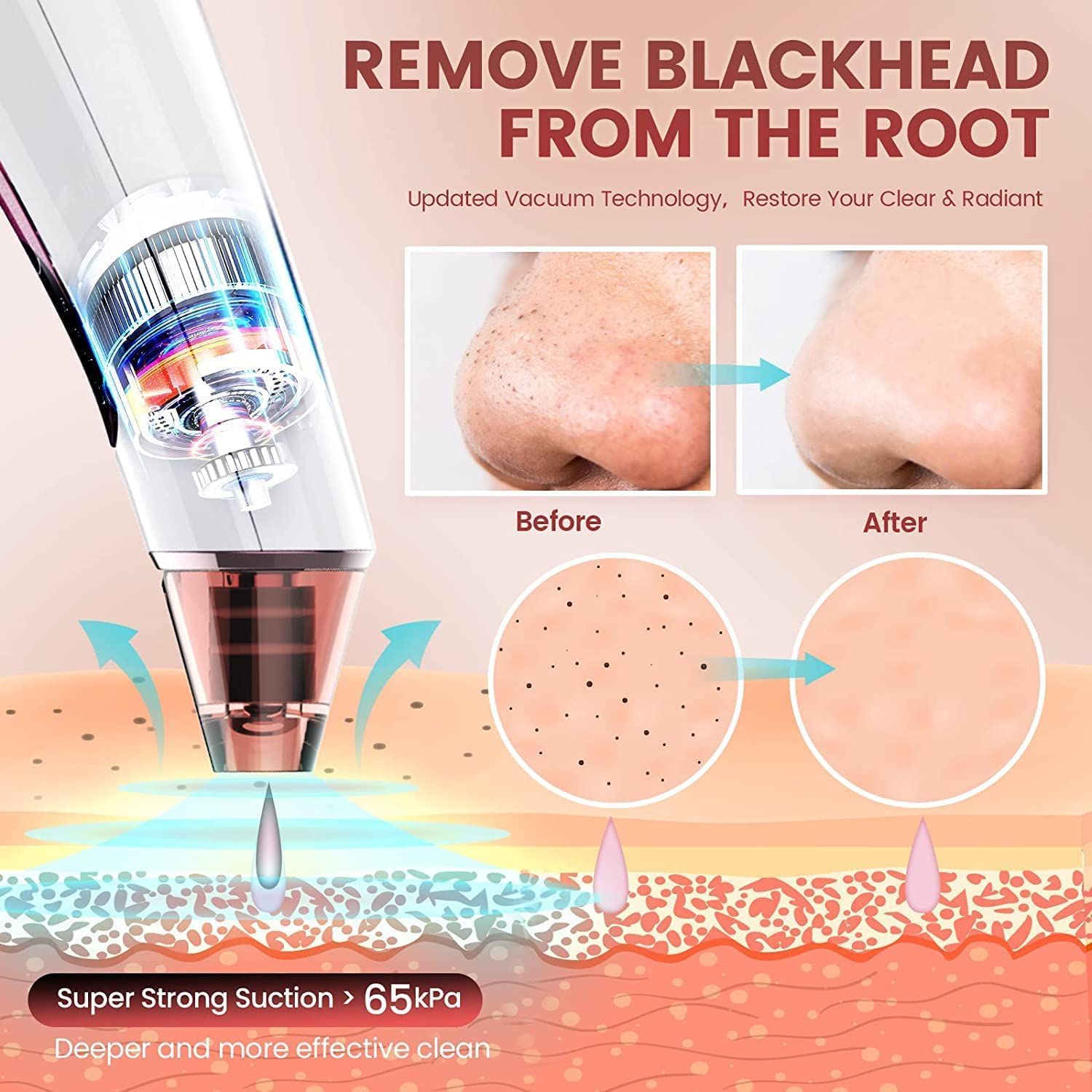 Blackhead Remover Vacuum Electric Pore Suction Remover Tools Acne Comedone Extractor Tool