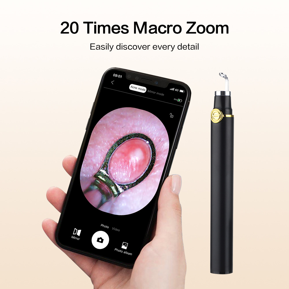 (Black) Blackhead Remover Smart Visual Acne Needle Cleansing Cosmetic Devices Acne Squeeze Pore Cleaner Facial Treatment Skin Care Tools