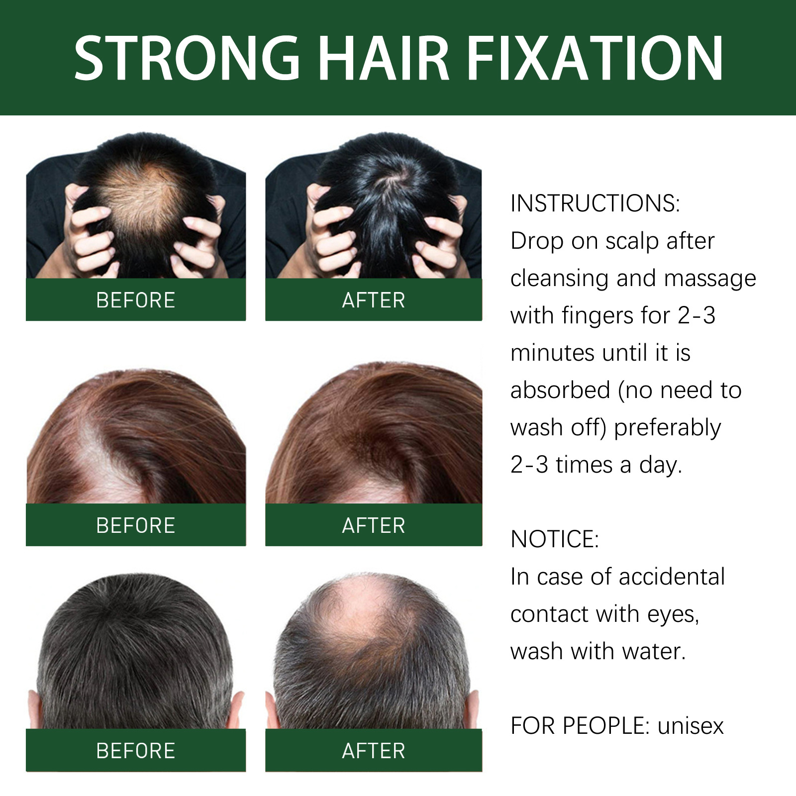 Ginger Hair Growth Essence Hair Care Oil 7 Day Ginger King Serum Nourishing Hair Nutrition Dense Hair Nutrient Solution 30ml
