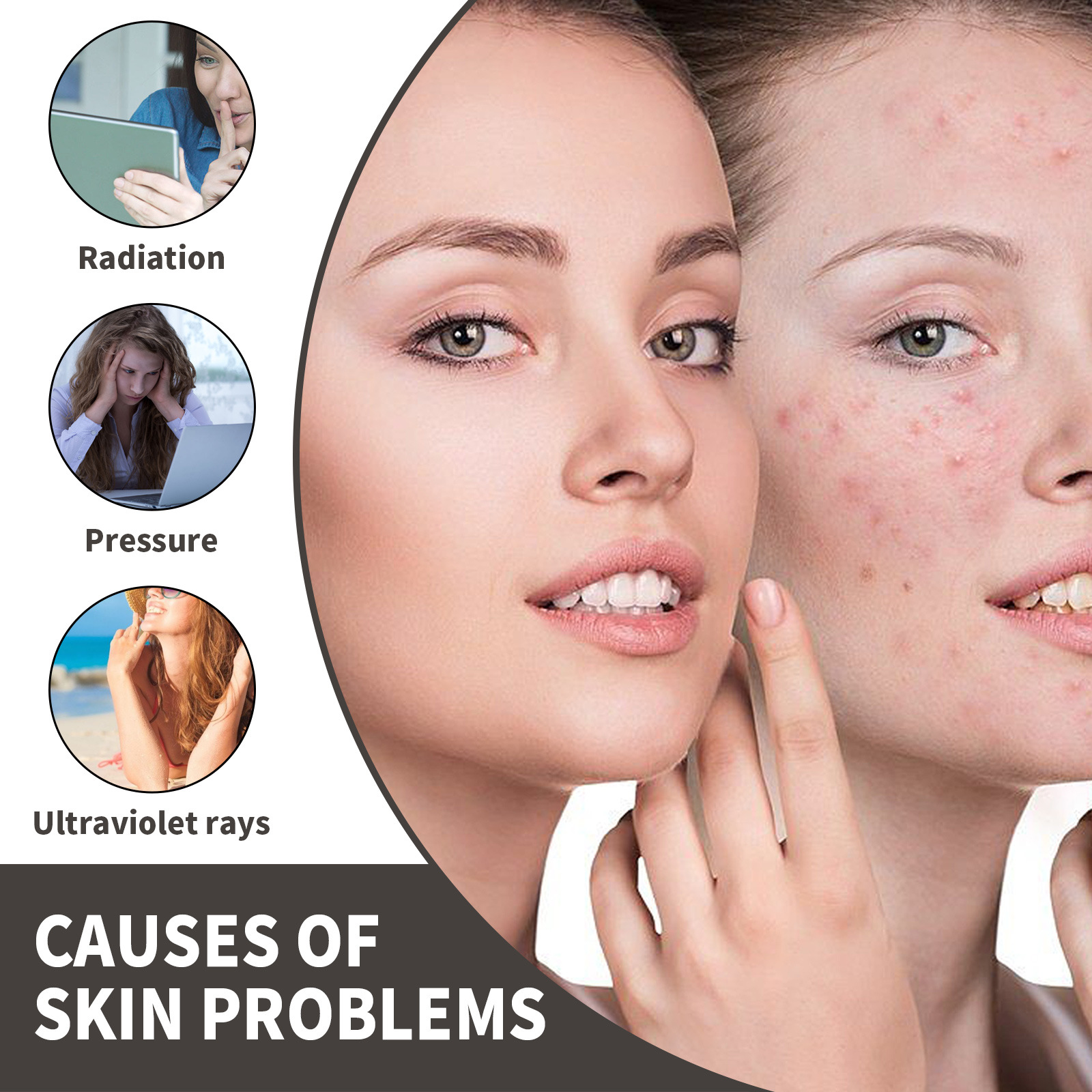 OUHOE Whitening Serum Remove Dark Sp-ots Pigm-entation Melasma Ac-ne Ma-rks Anti-aging Lift Firm Brightening Tender Skin Serum