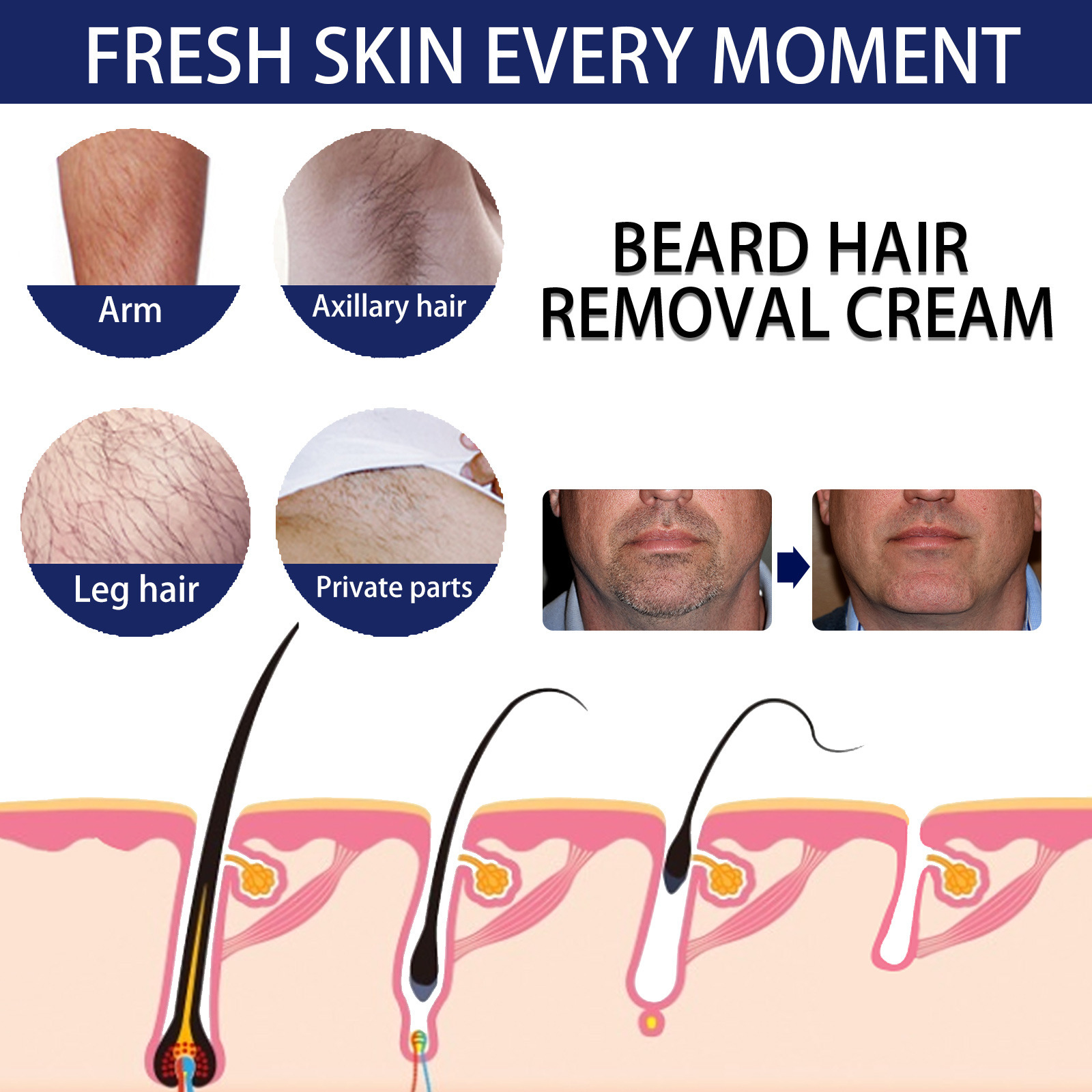 Men Hair Removal Cream For Gentle Chest And Beard Cleansing Soothing Moisturizing Non Irritating Daily Grooming Treatment