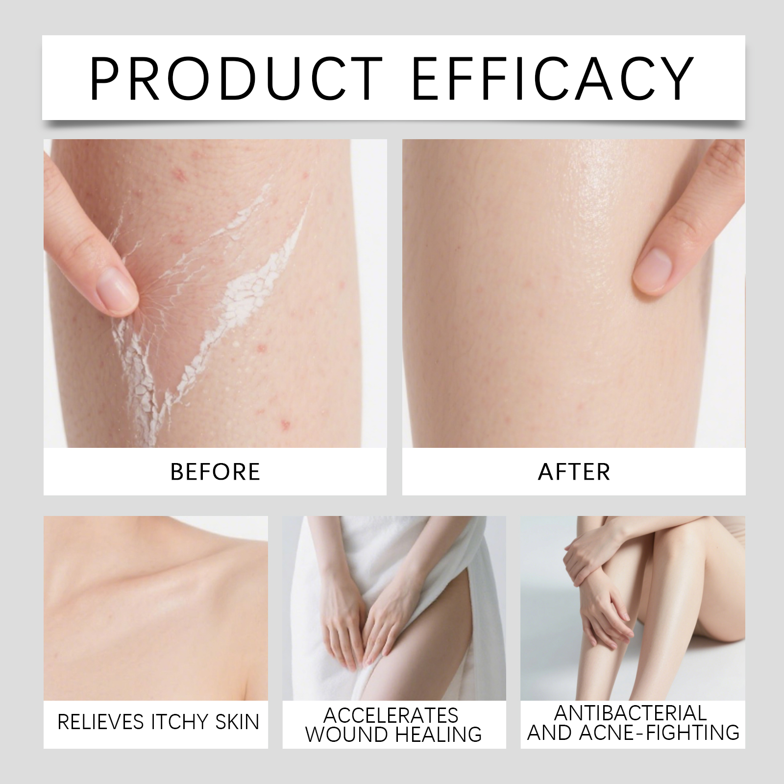 Herbal Skin Care Cream Deep Moisturizing Silky Texture Nourish Skin Relieve Dry Tight Daily Application On Body
