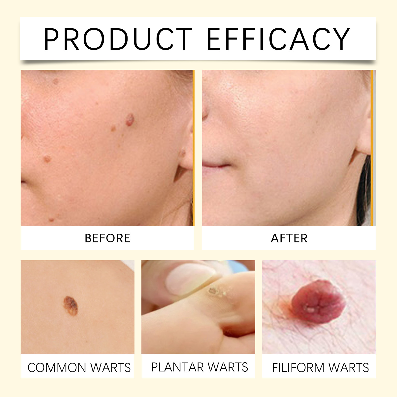 Skin Care Patch Mild Clean Moisturize Body Face Skin Daily Special Protect Complex Care