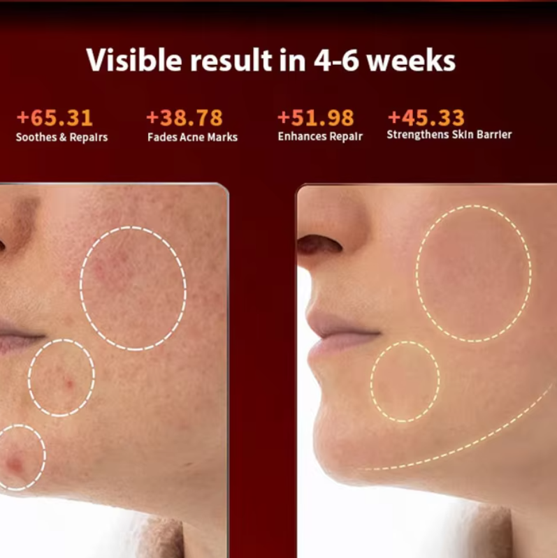 Beauty Mask Silicone Ice Mask Compress LED Red Blue Light Whitening Rejuvenation Large Row Light Electronic Beauty