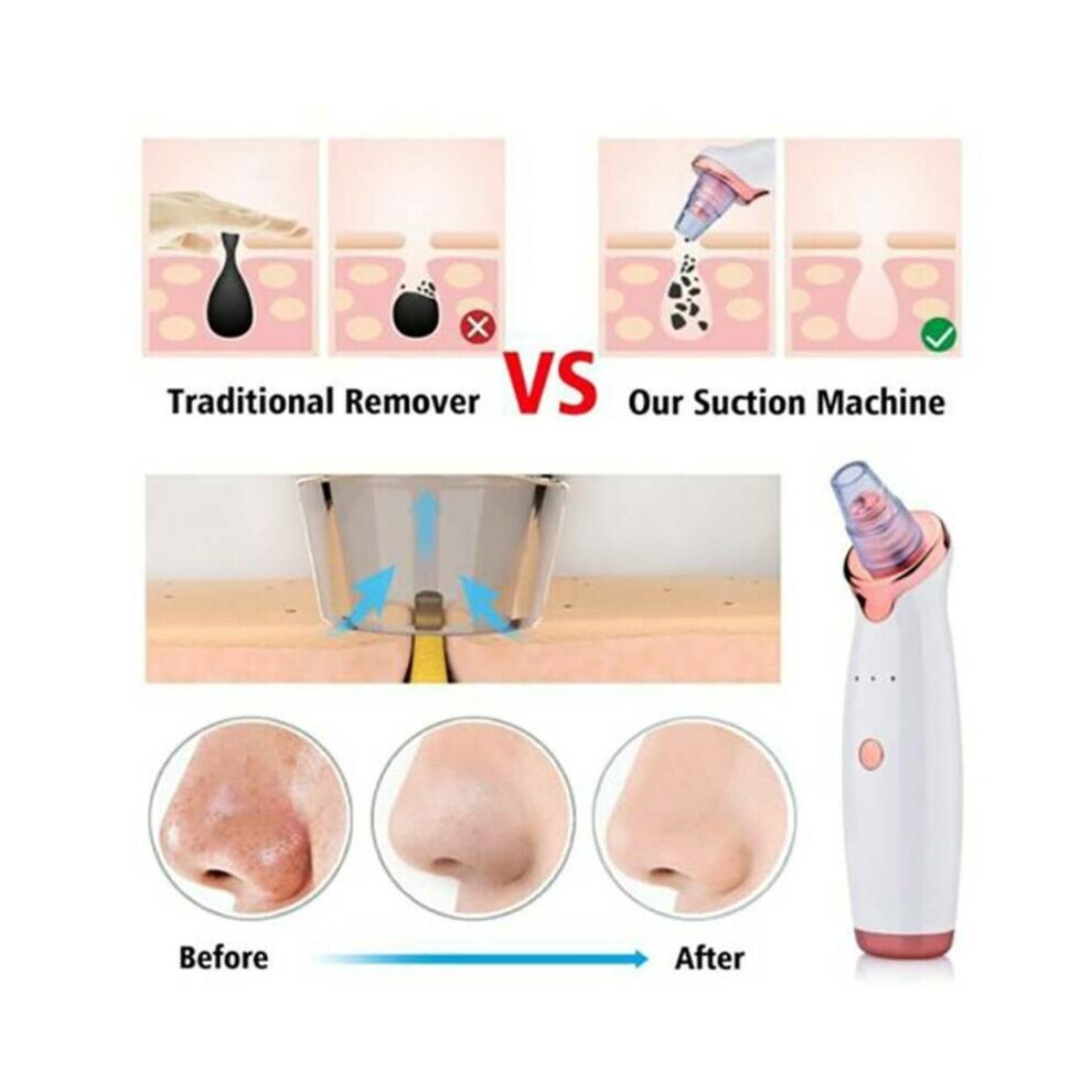 Electric Blackhead Remover Vacuum Acne Suction Facial Skin Deep Cleaner Machine