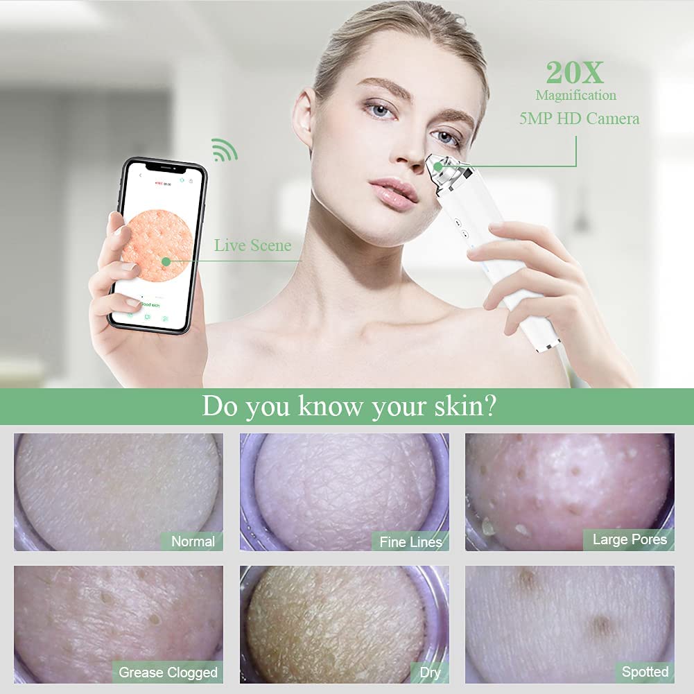(White) Blackhead Remover Vacuum WIFI Visible Facial Pore Cleanser with HD Camera Pimple Acne Comedone Extractor Rechargeable Electric Black Head Suction Tool