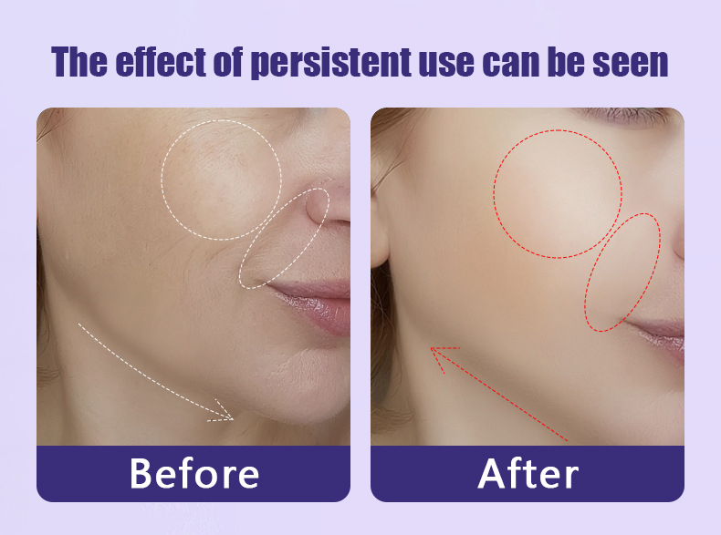 7 Color LED Led Light Therapy Neck Beauty Instrument Fade Neck Lines Nasolabial Beauty Massager Double Chin Remove Skin Rejuvenation V Face Lifting