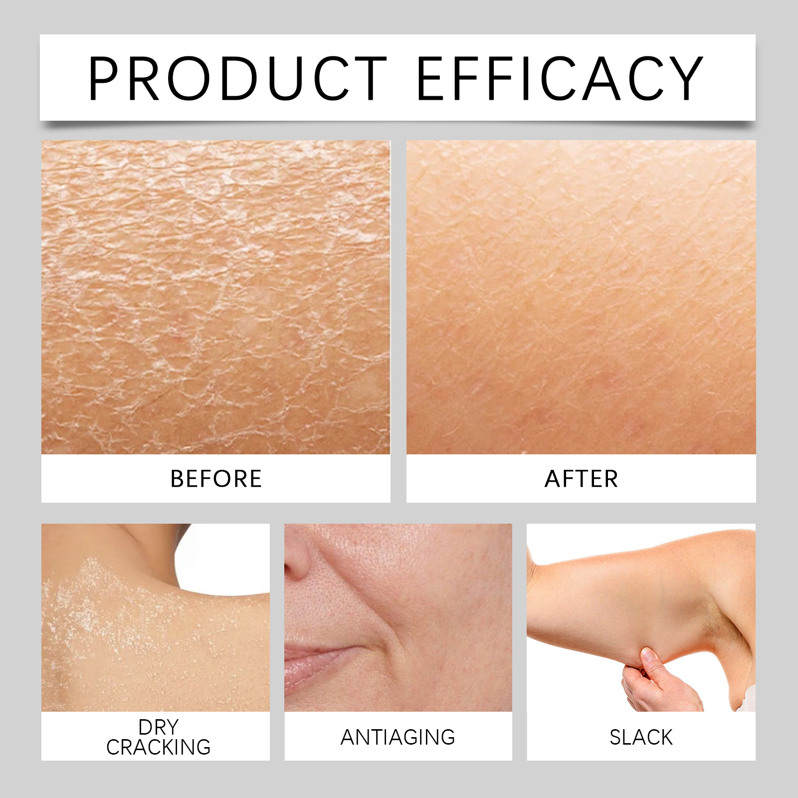 Bee Venom Skin Cream Firming Soothing Hydrating Nourishing Moisturizing For Daily Facial Skin Care