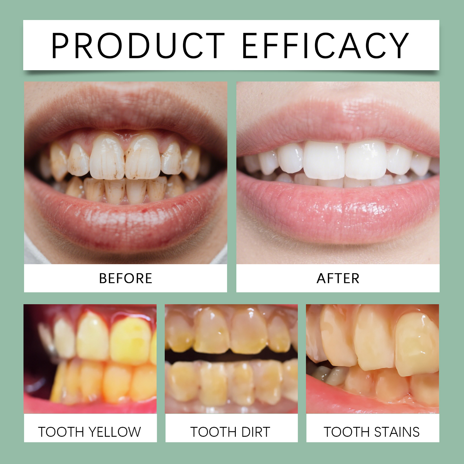 Gum Care Toothpaste Dense Foam Fresh Mild Soft Protect Remove Stains Daily Oral Clean