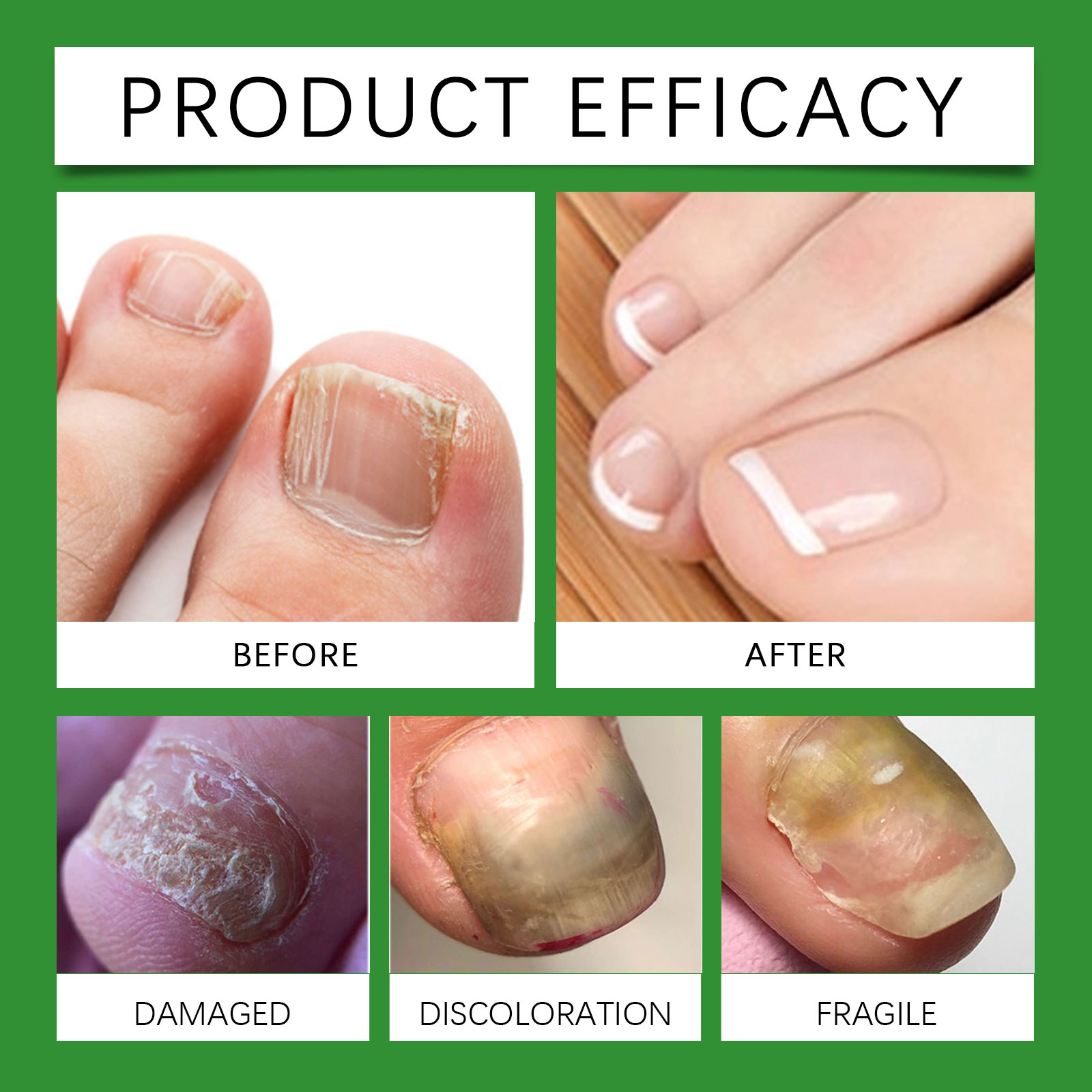 Nail Care Patch Moisturizing Hydrating Close Fingernail Mild Protect Portable Simple Daily Treatment