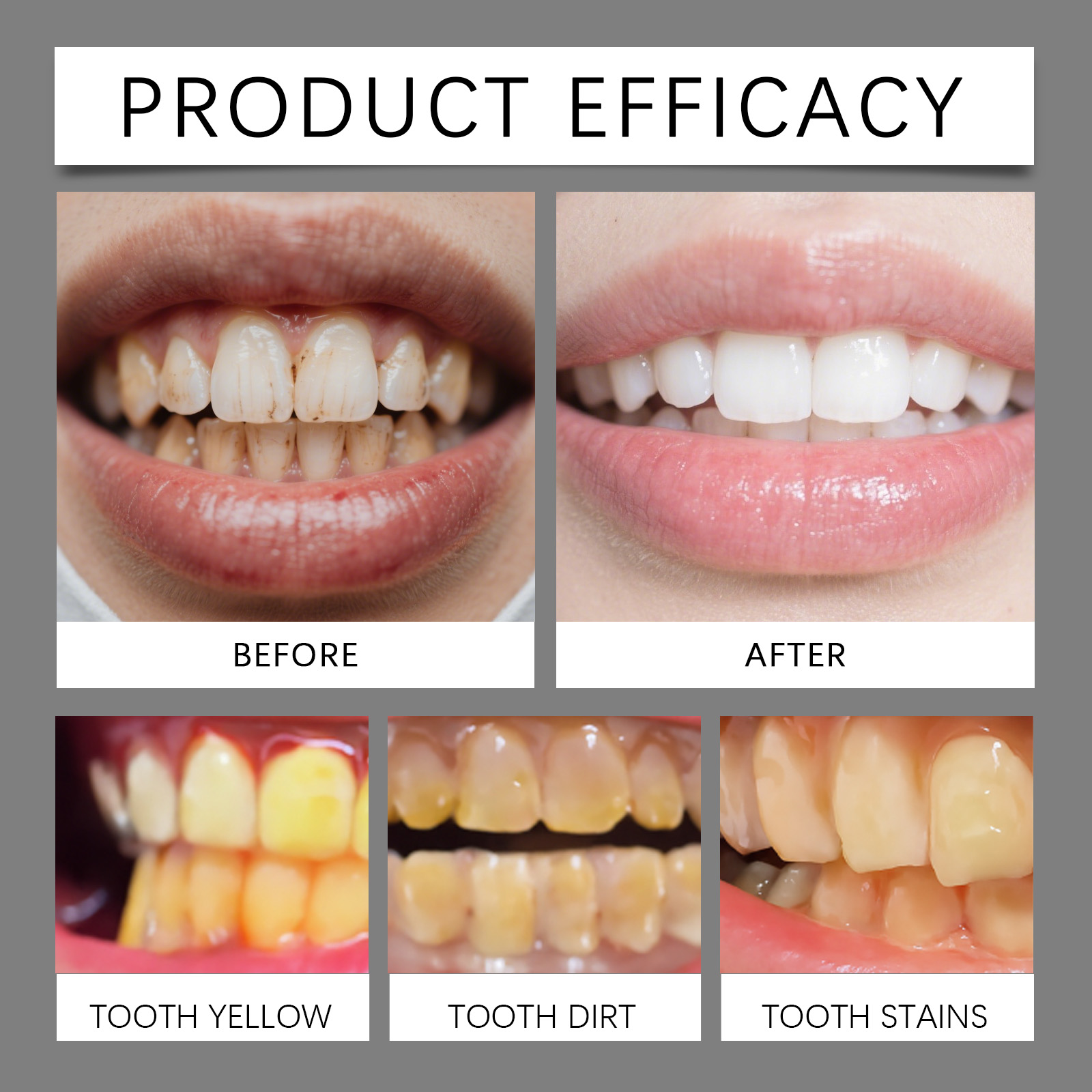 Brightening Dental Mousse Gentle Cleansing Protecting Glossy Teeth Press Type Daily Oral Care