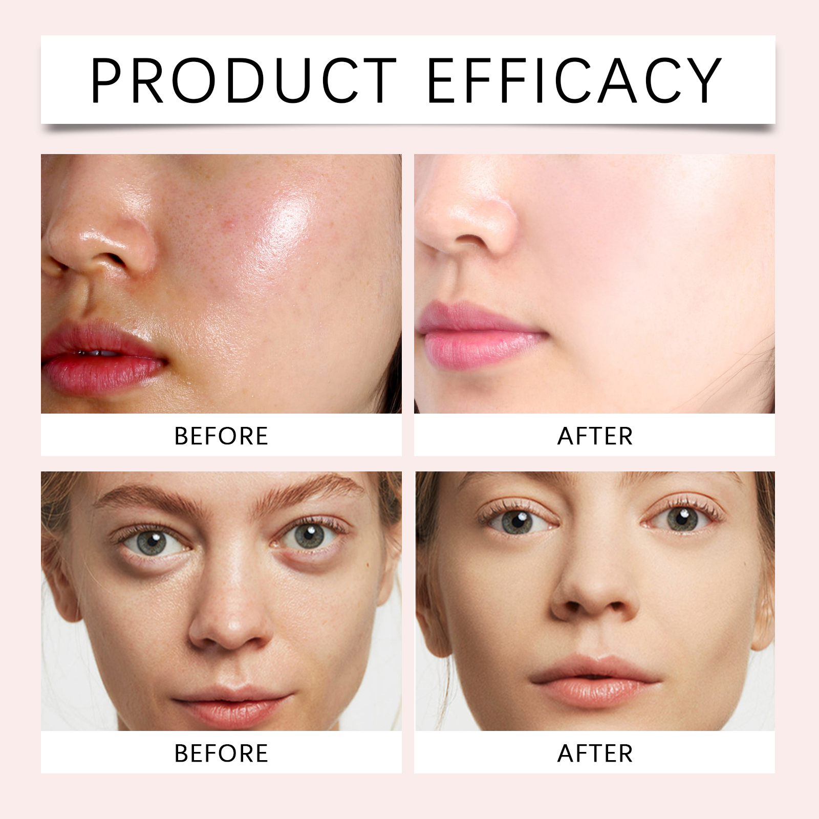 Niacinamide Pore Tightening Serum Hydrating Moisturizing Oil Control Remove Closed Comedones Soothe Skin