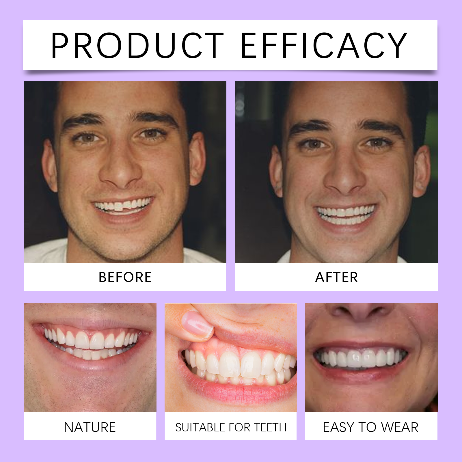 Denture Modifying Braces Teeth Beautification Smile Enhancement Comfort Care Set For Teeth Wear Protection Accessory