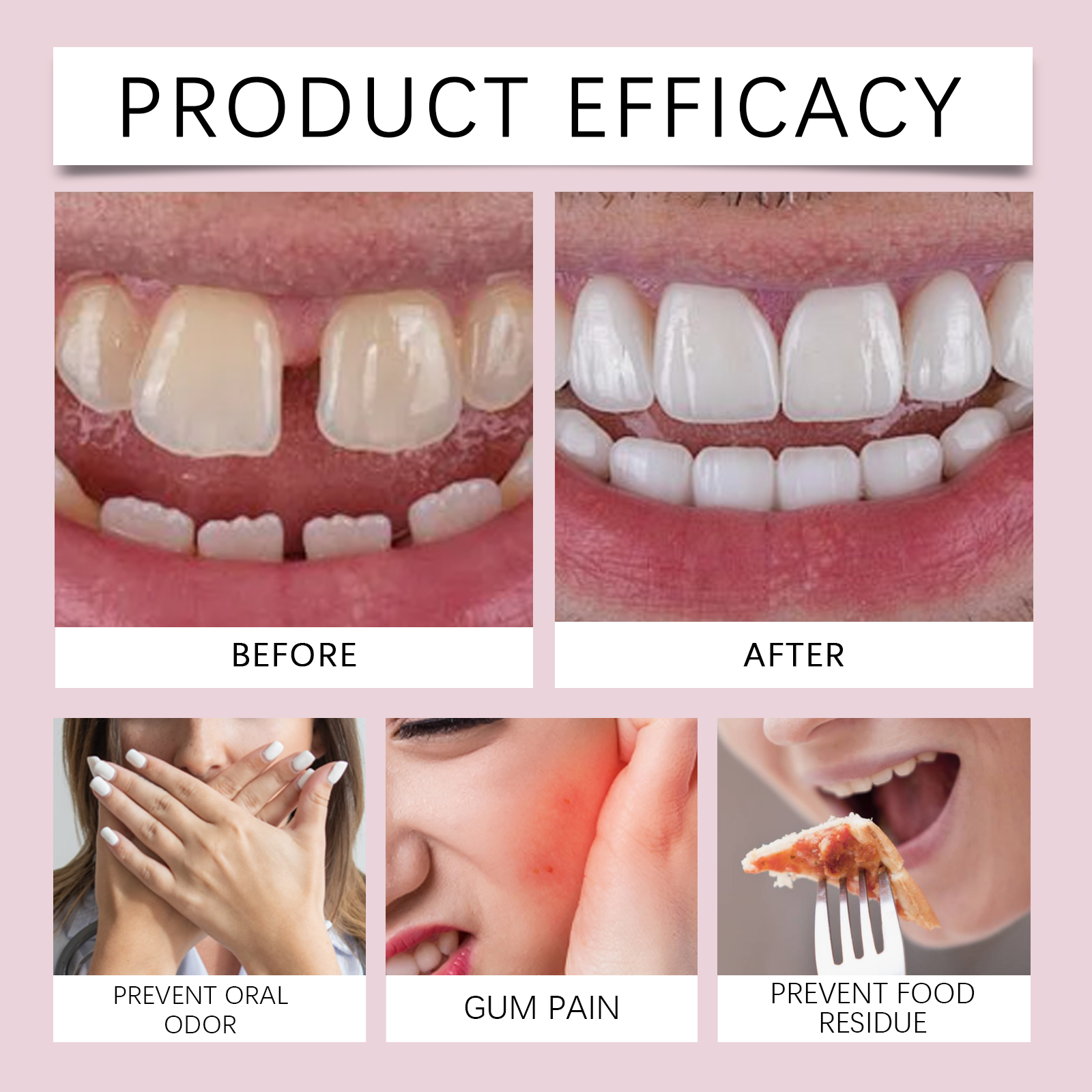 Denture Adhesive Cream Long Lasting Secure Hold For Comfortable Wear Daily Oral Care