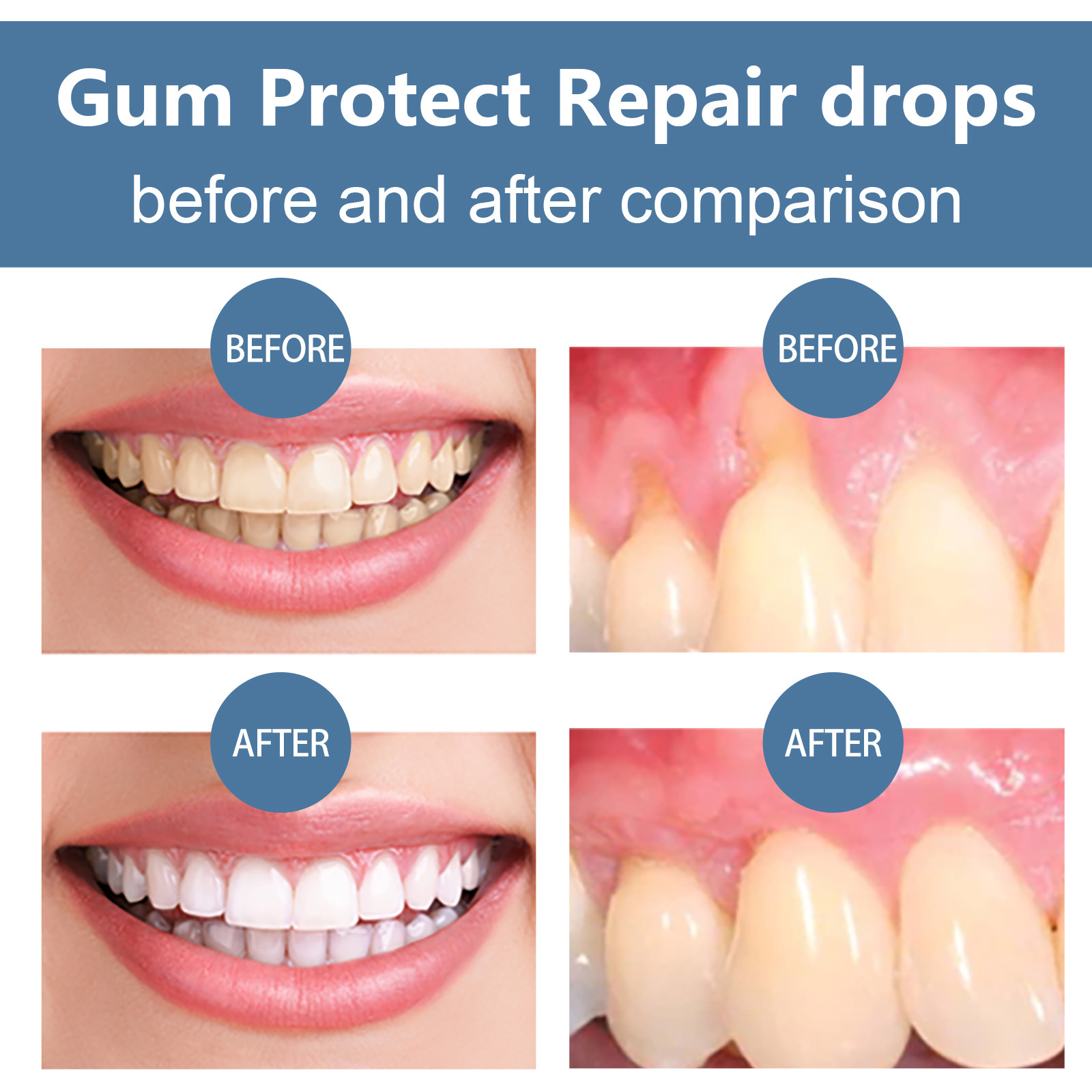 EELHOE Natural Gum Repair Drops Mouth Periodontal Relieve Teeth Whitening Oral Treatment Gum Care Gingival Growth Liquid Product Teeth Whiteners