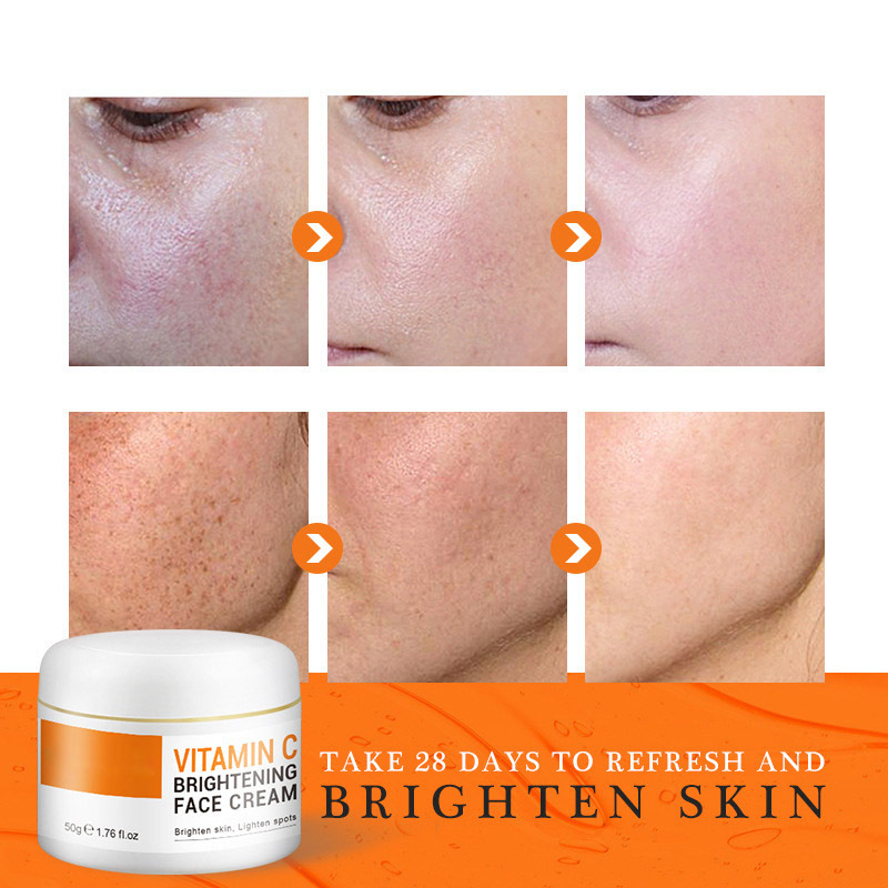 Vitamin C Face Cream Skin Care Pigment Spots Freckles Remover Whitening Moisturizing Anit-Aging Cosmetics Korean Beauty Health