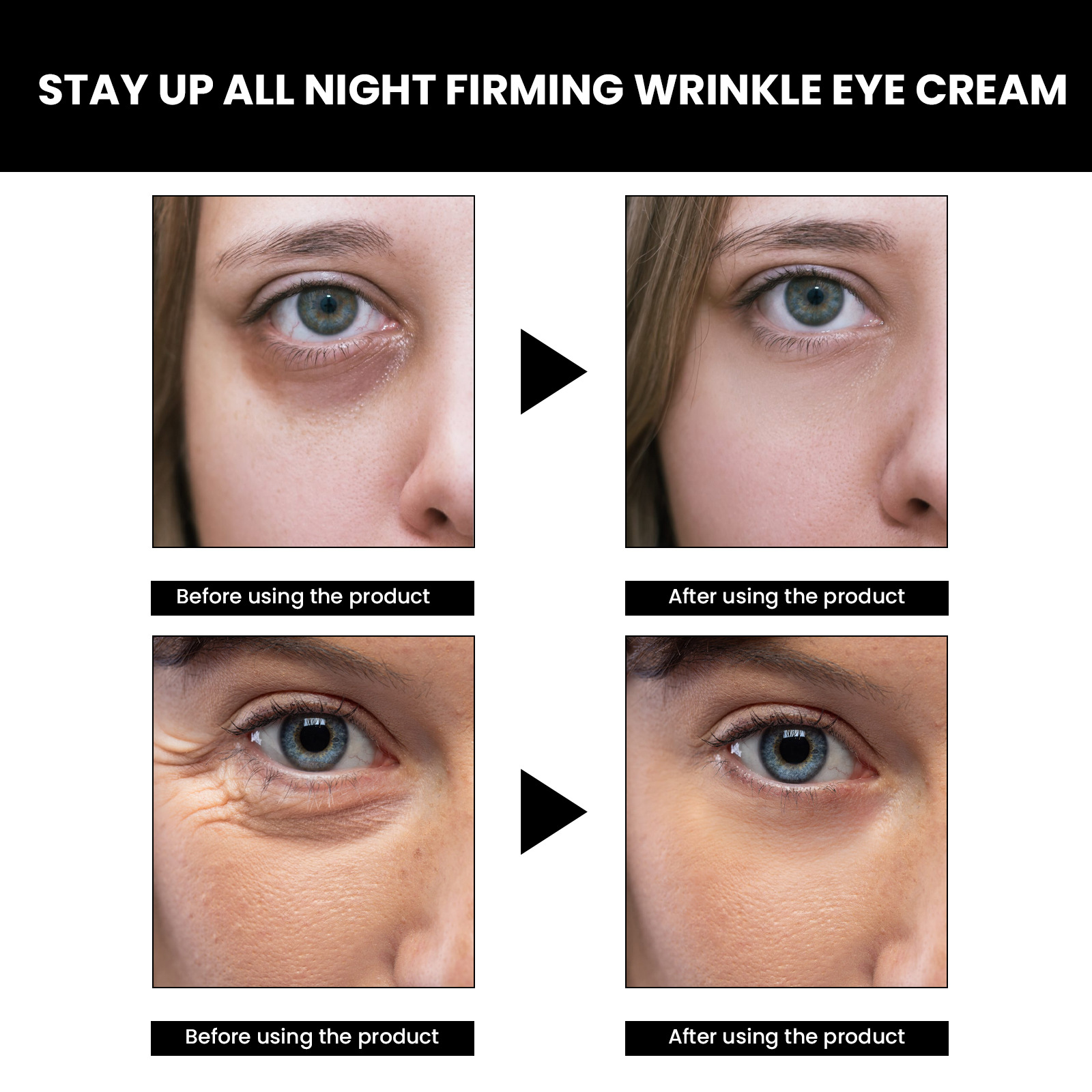 EELHOE Eye Tightening Cream Reducing Fine Lines Firming Anti Dark Circle Repairing Roughness Whitening Nourishing Dry