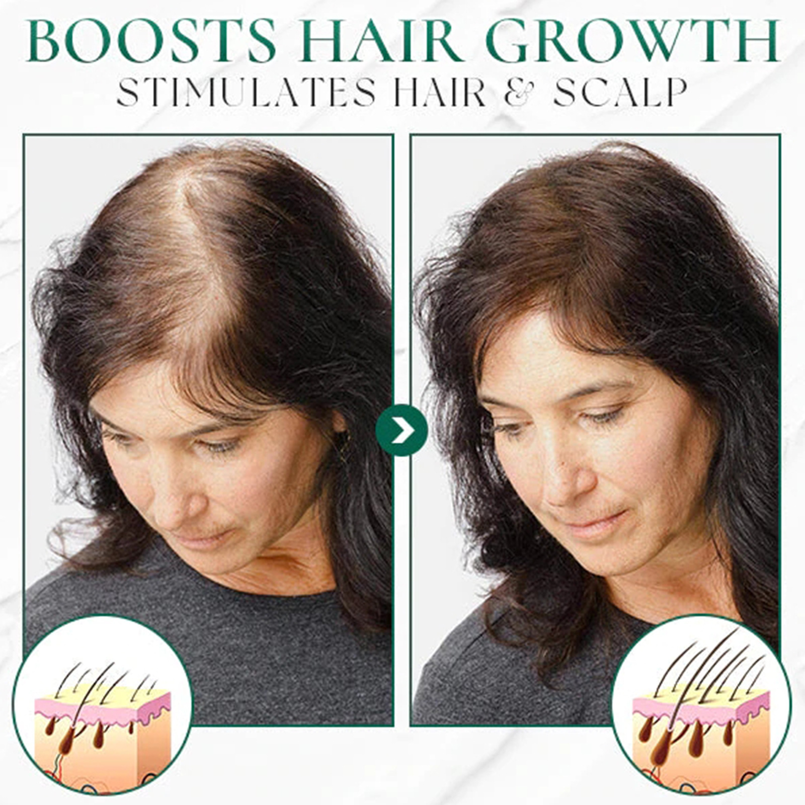 Centella Exfoliating Scrub for Hair Oil Control Deep Cleansing Dandruff Removal Repair Damaged Hair Scalp Massage Scrub Cream