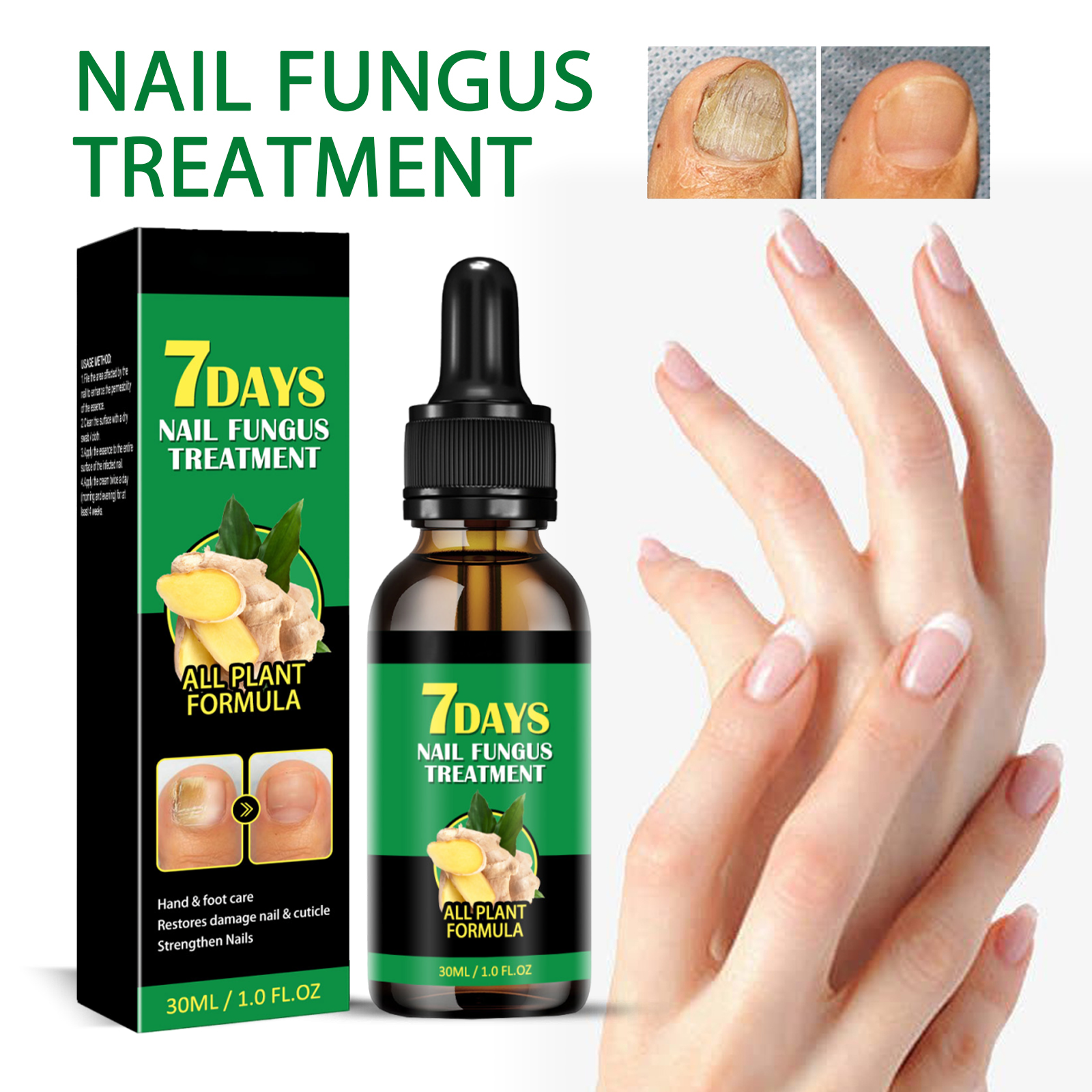 Ginger Nail Care Liquid Repair Soft Shiny Moisturize Hand Foot Toe Nail Onychomycosis Treatment Serum
