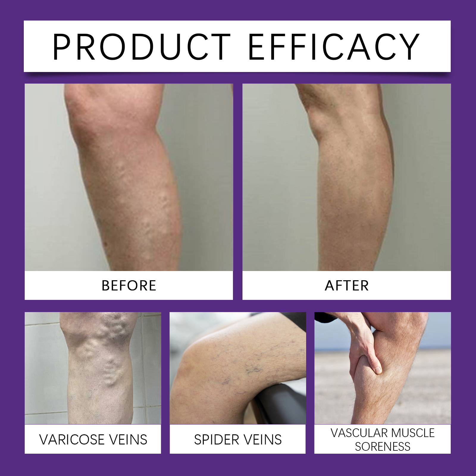 Leg Care Cream Mild Ingredients Daily Nourishing Comfortable Ease Discomfort Massage Skin Lotion For Body Leg Skin