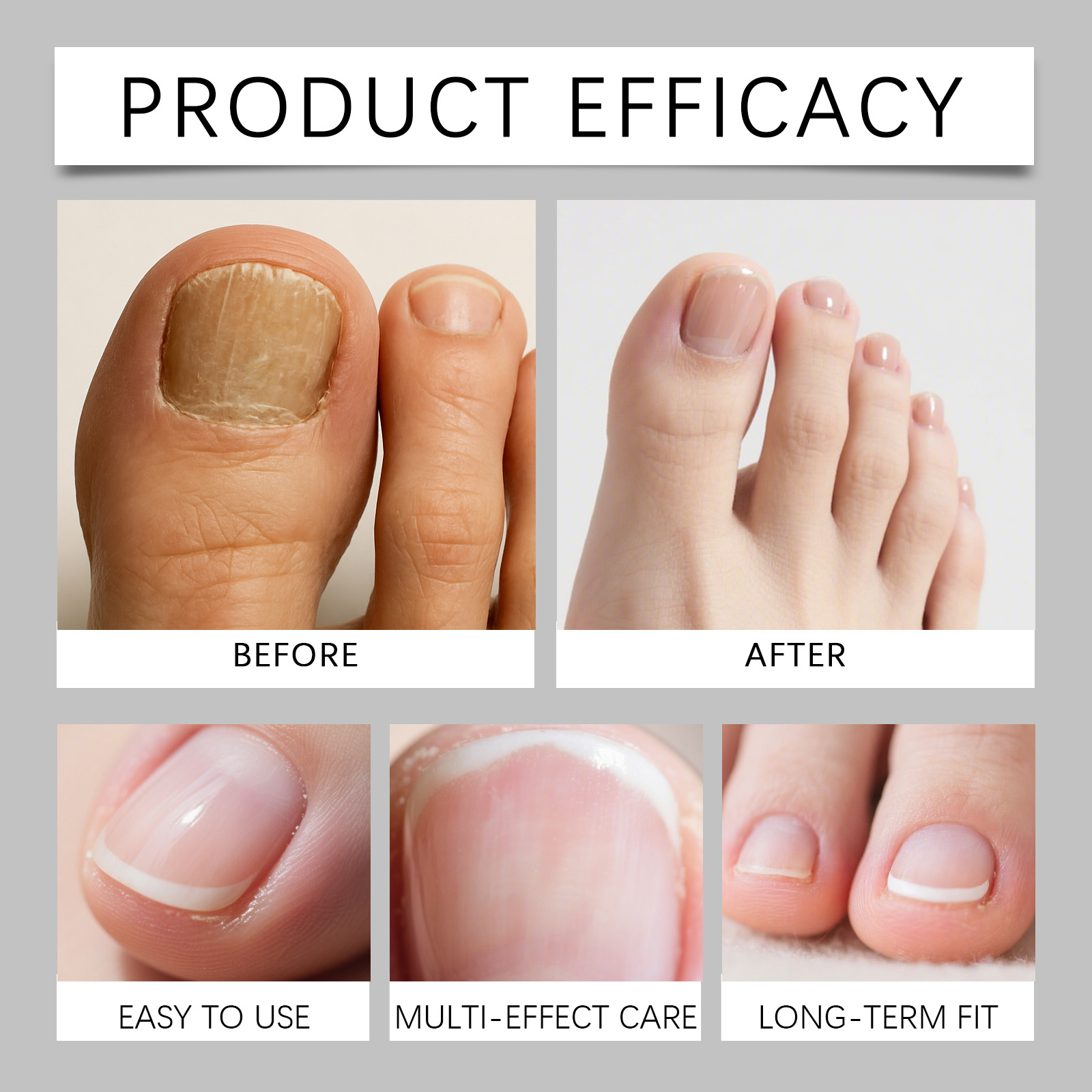 Nail Care Patches Mild Nourishing Gentle Skin Friendly Close Fitting Convenient For Manicure Daily Maintenance