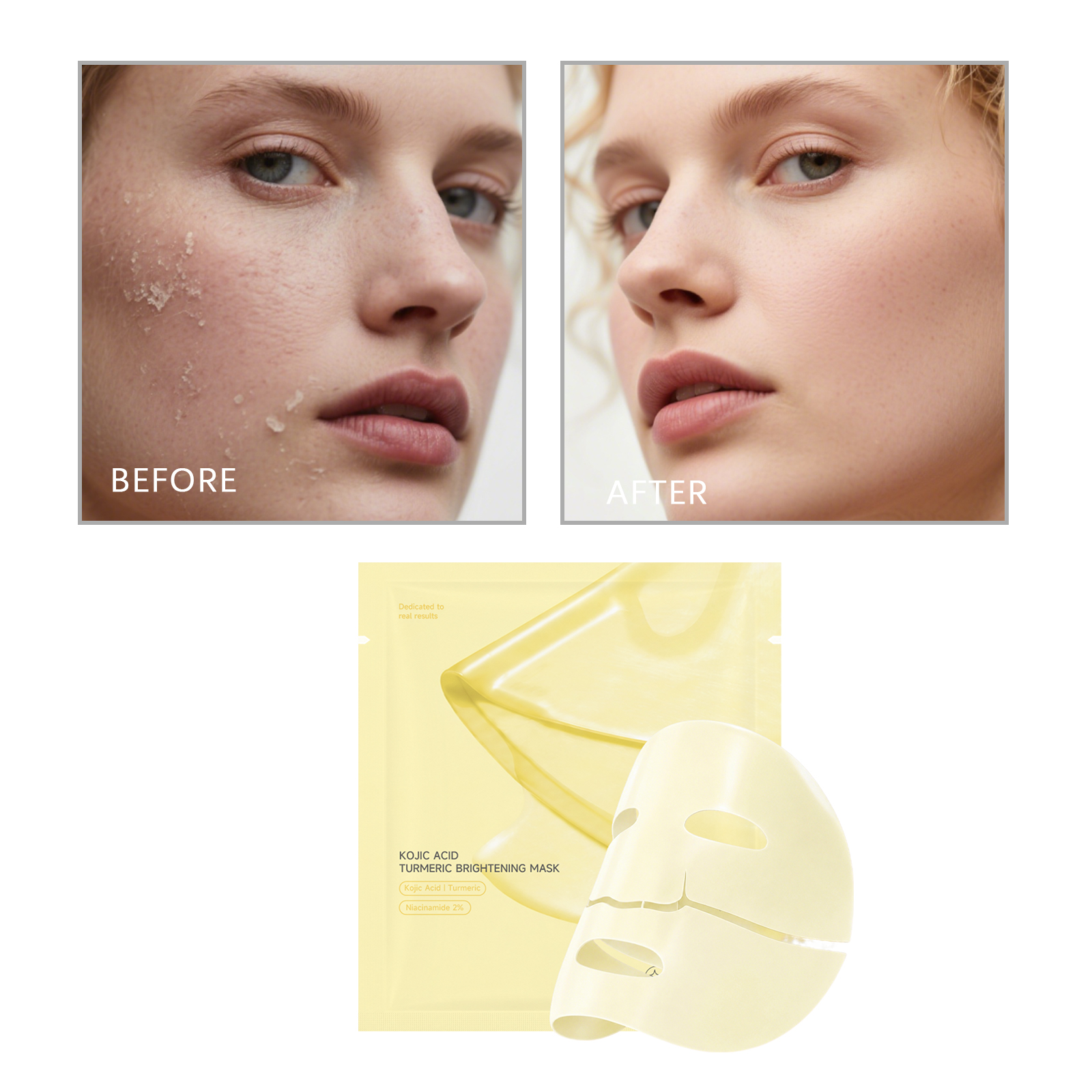 Kojic Curcumin Brightening Facial Mask Bag Hydrating Delicate Lightening Skin Facial Care