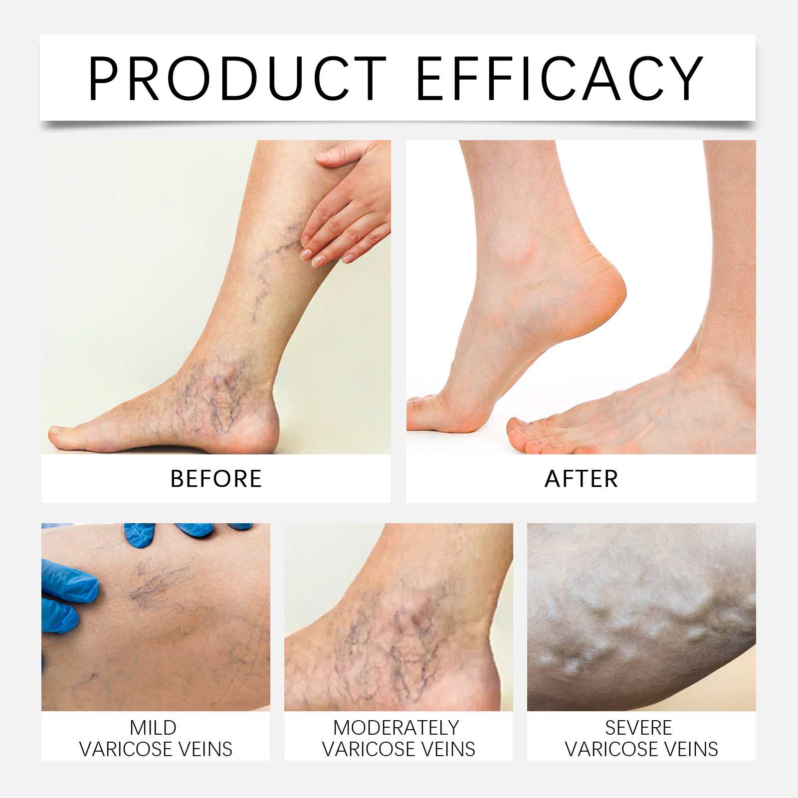 Leg Care Patch Mild Formula Moisturizing Soft Fit Skin Portable Easy Use Daily Body Care