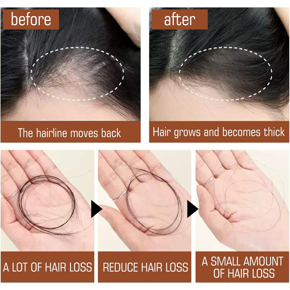 Batana Oil for Hair Growth – 100% Pure Organic Batana Oil, Raw &amp; Moisturizing Hair Butter for Healthy, Strong Hair